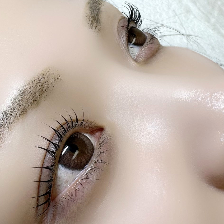 msm_eye
