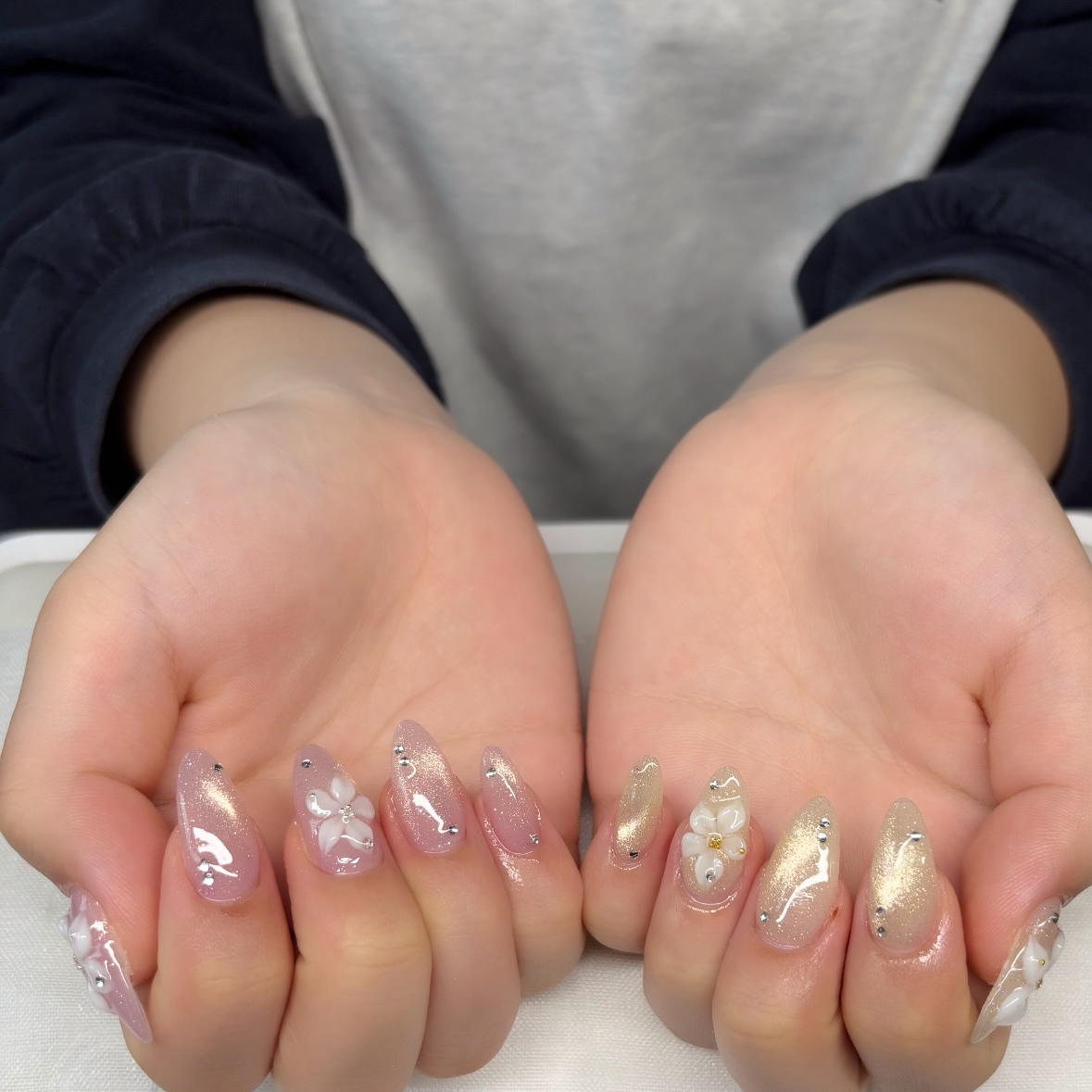 trangnail