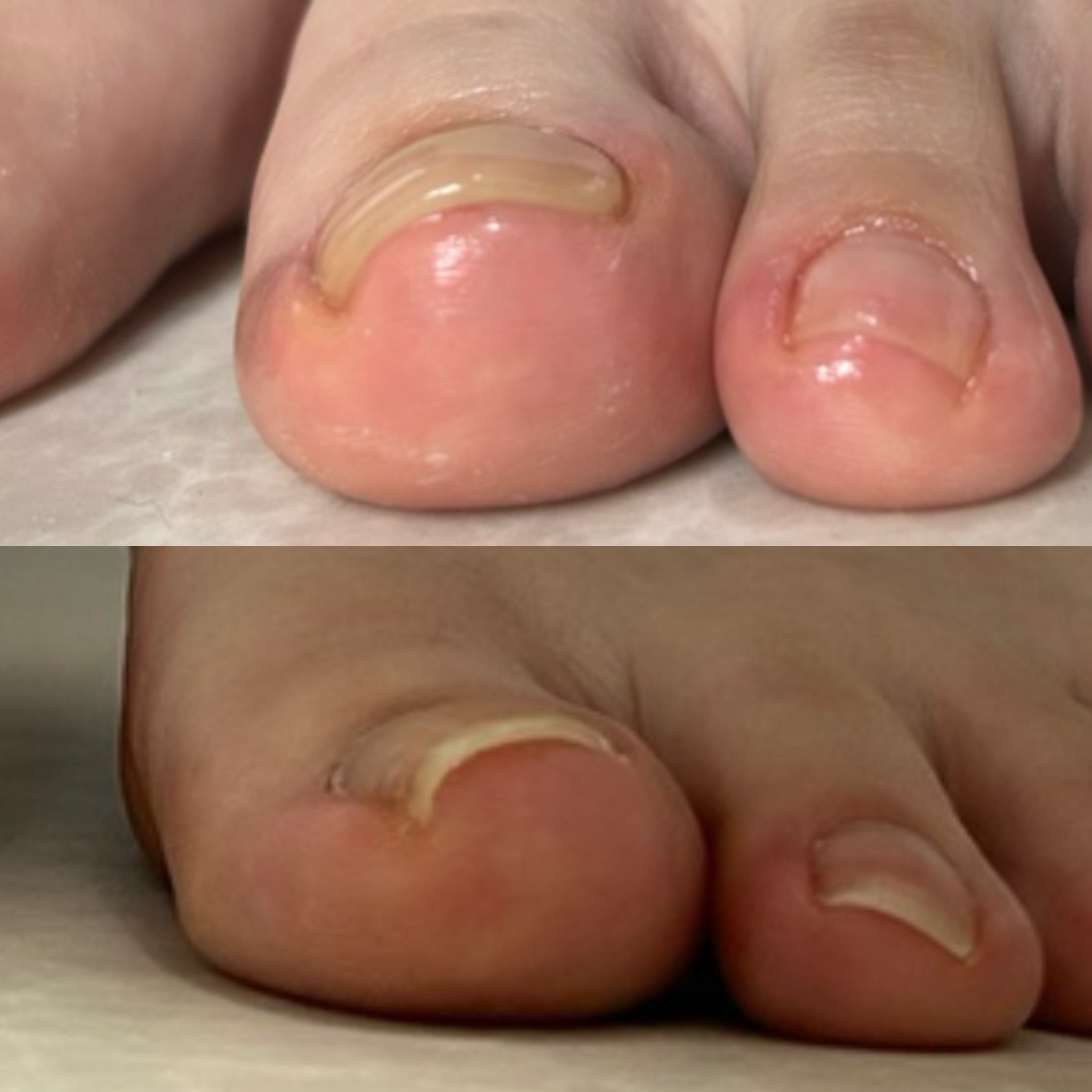 kicoco.nail