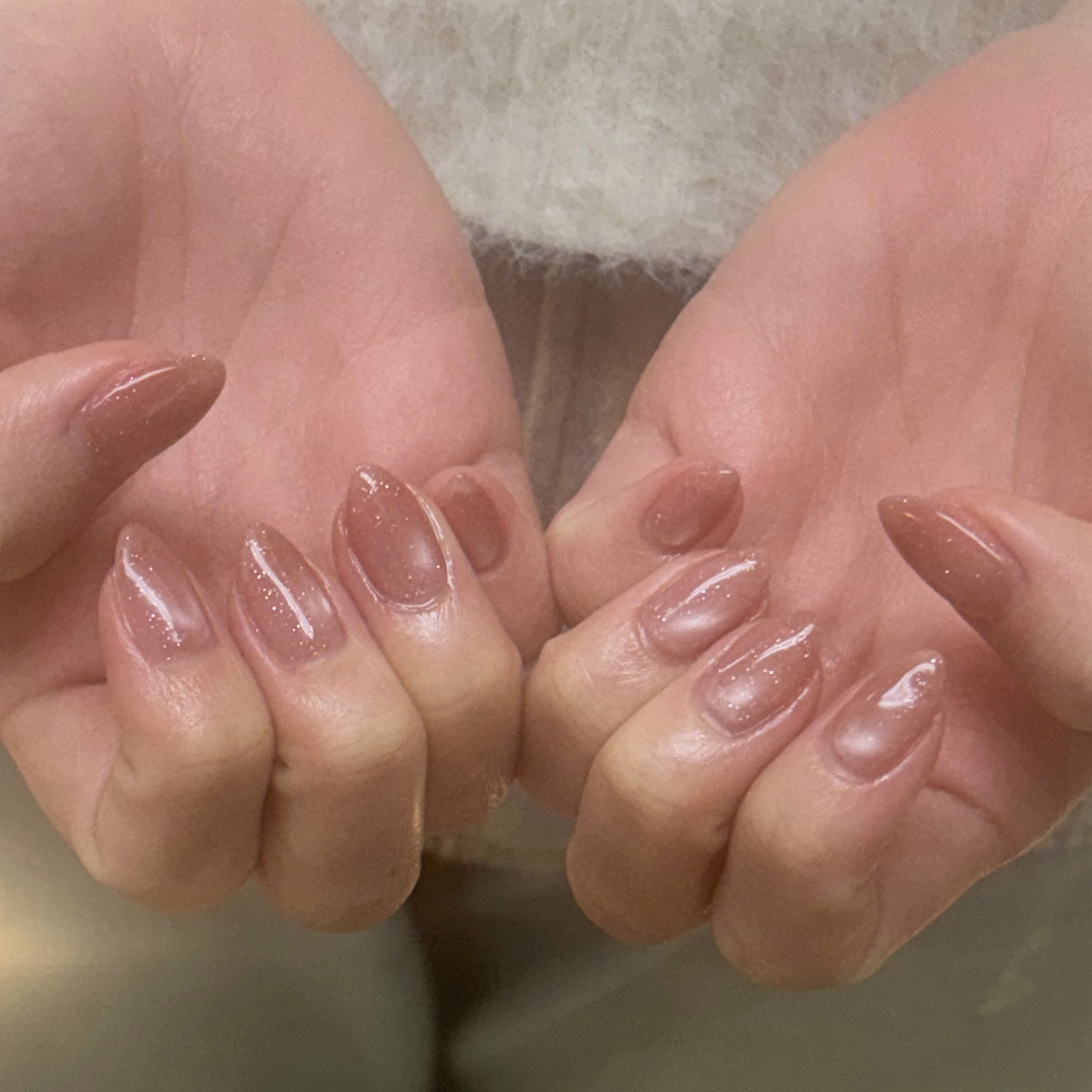 nail_trinity_scalp