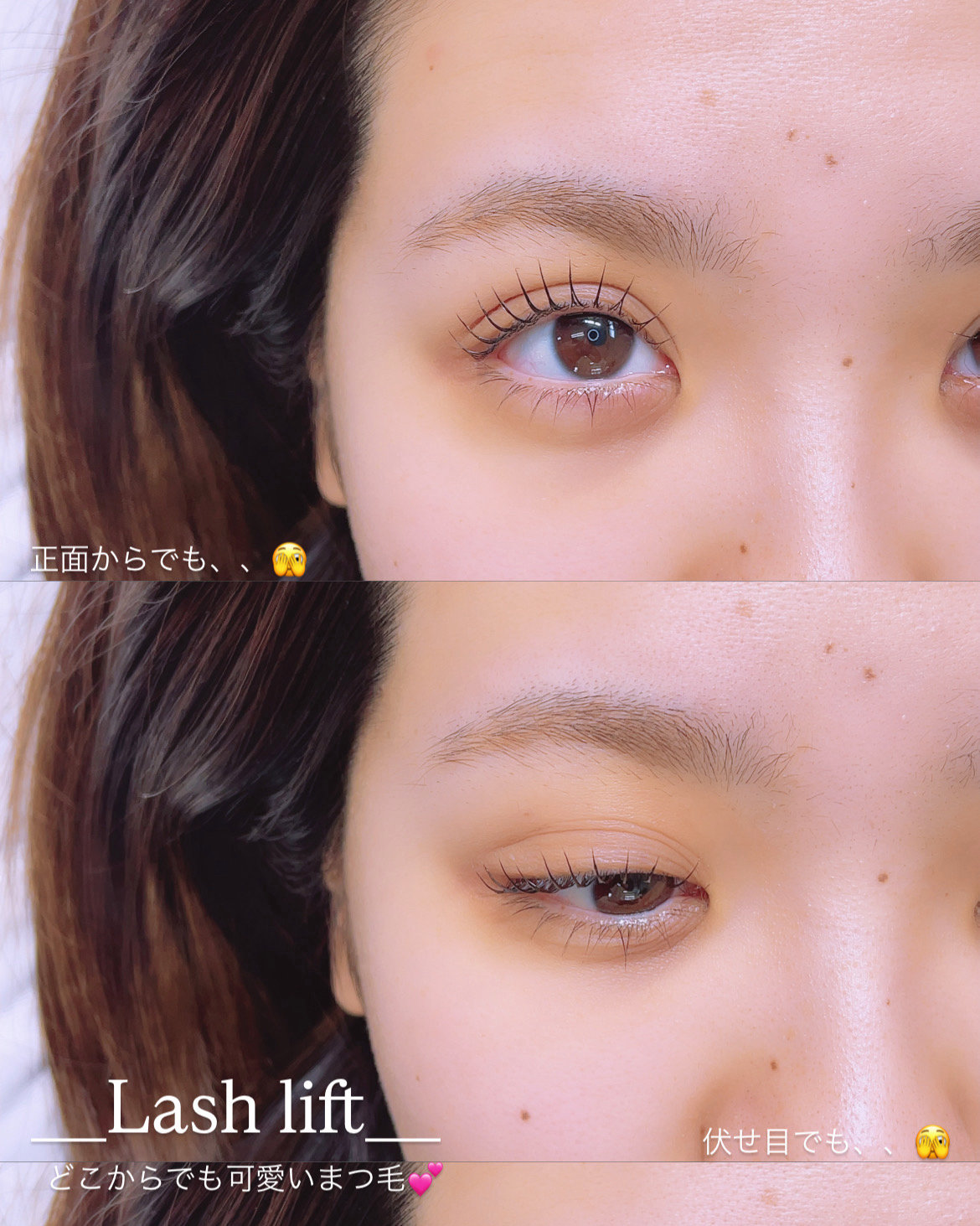 eye_su