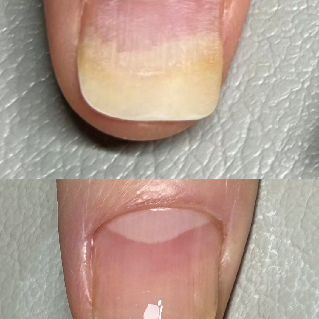 raik_nail