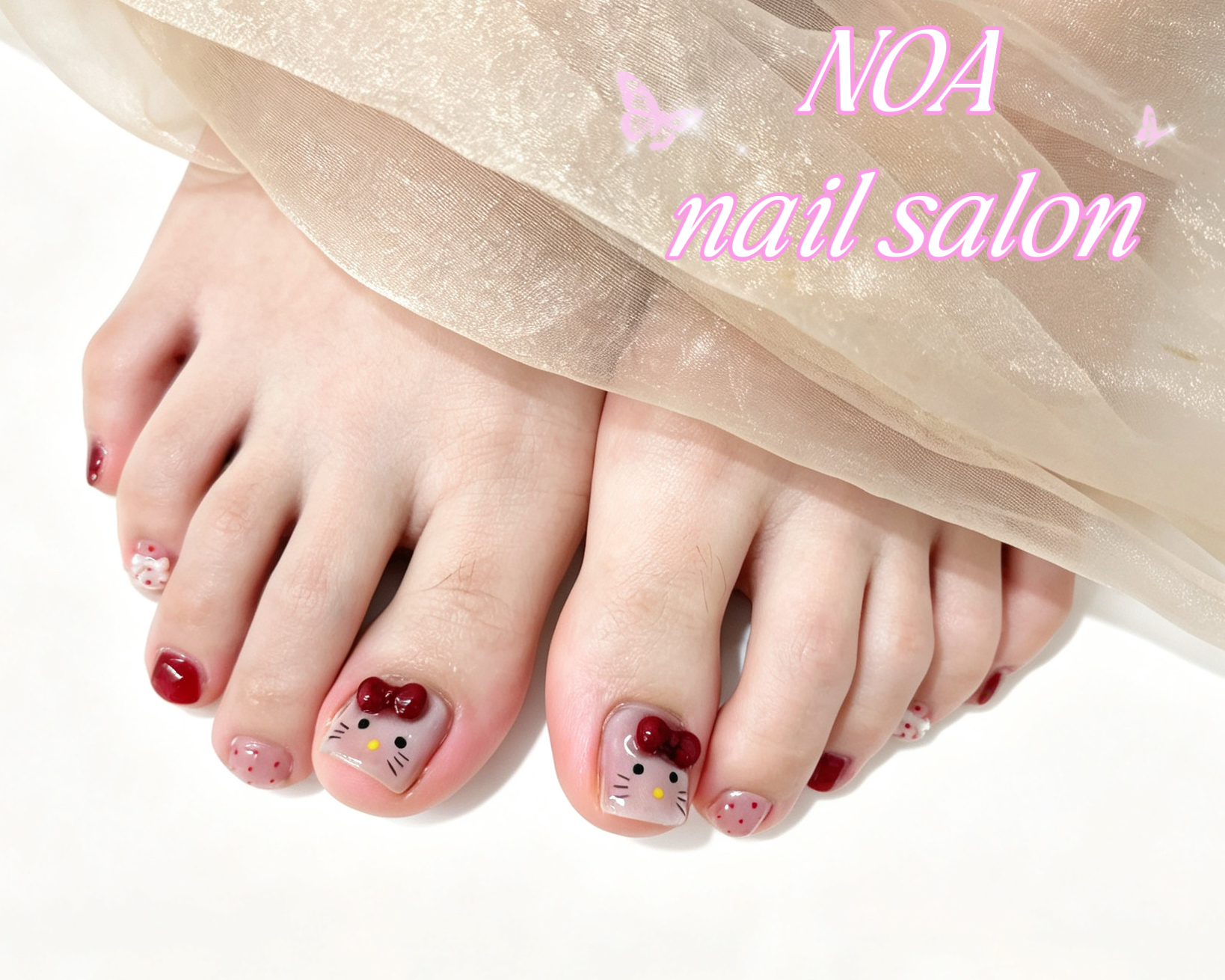 Noa_nail