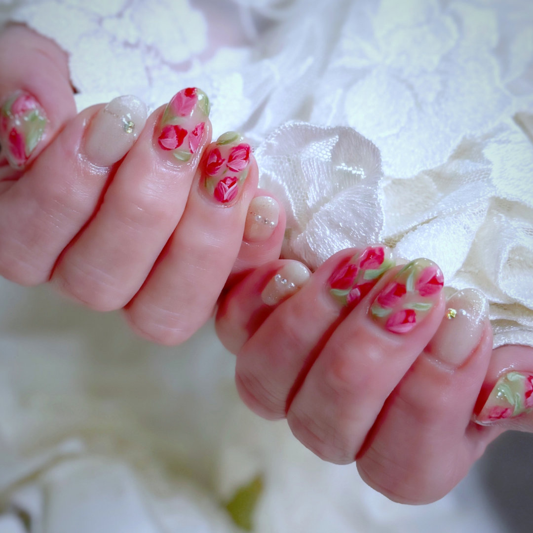 laangenail