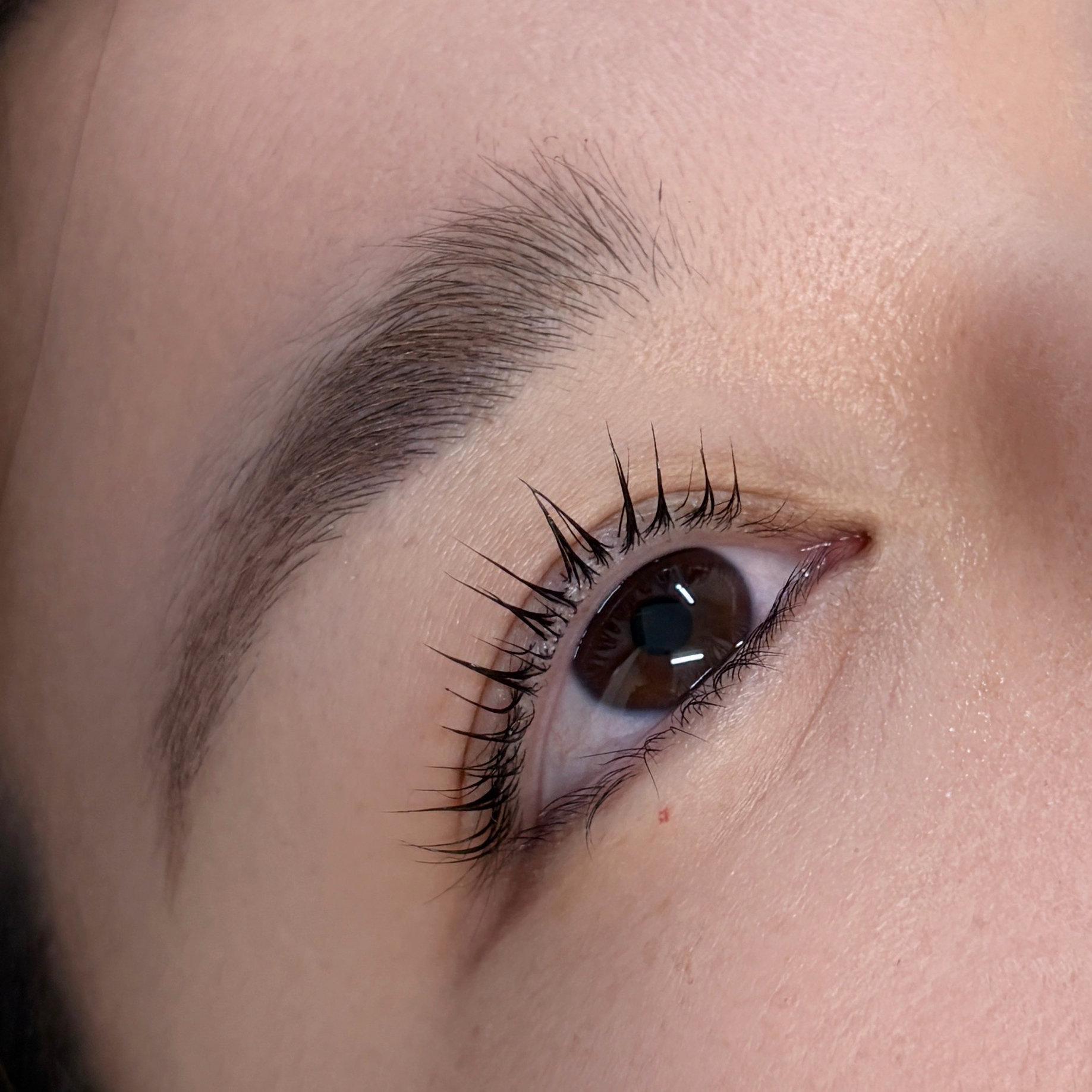 aoi__trueye