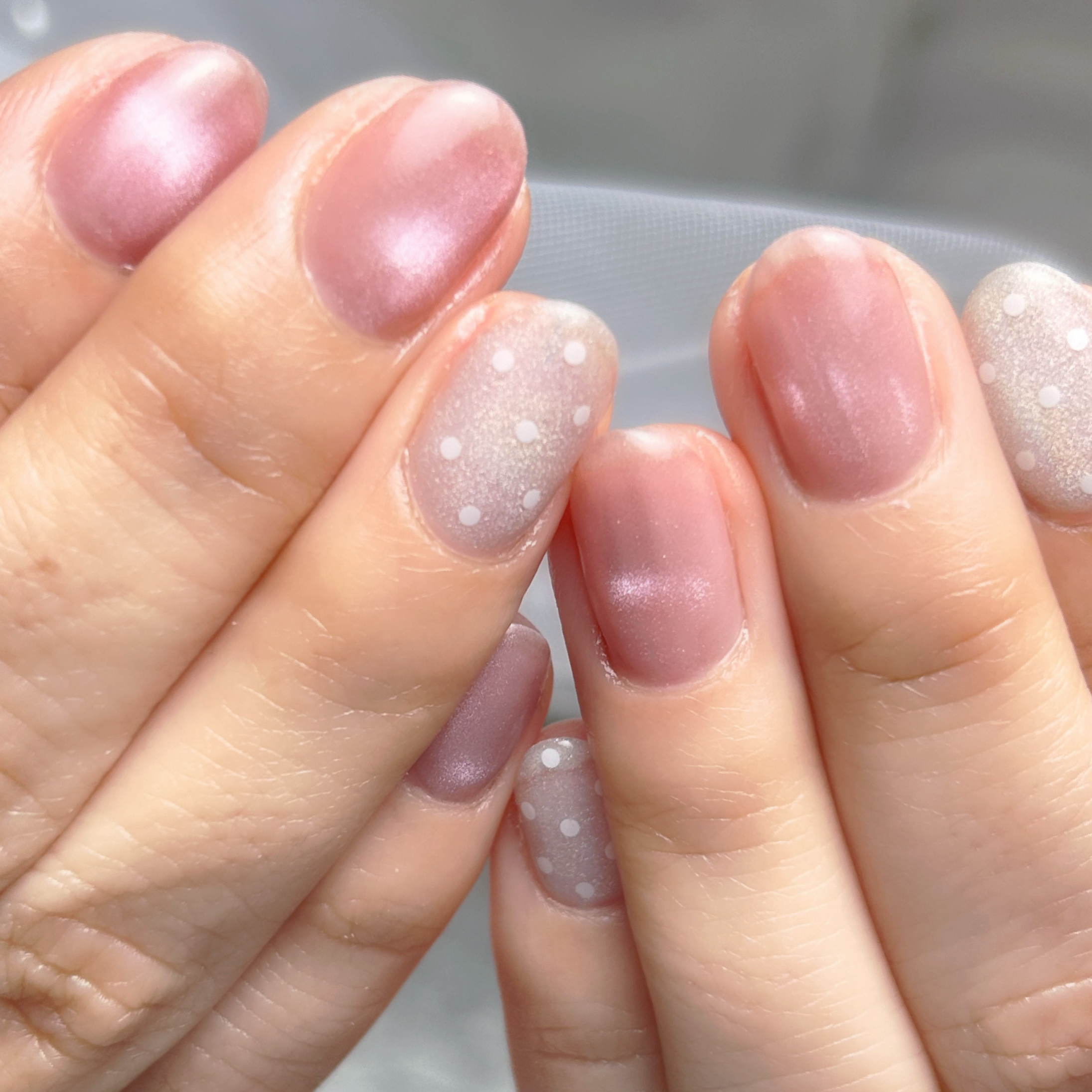 iter_nail_mio