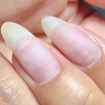 自爪風ネイル