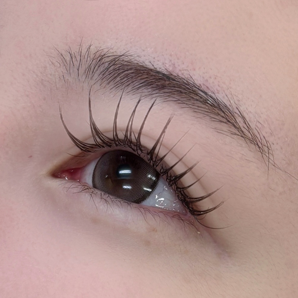 aoi__trueye