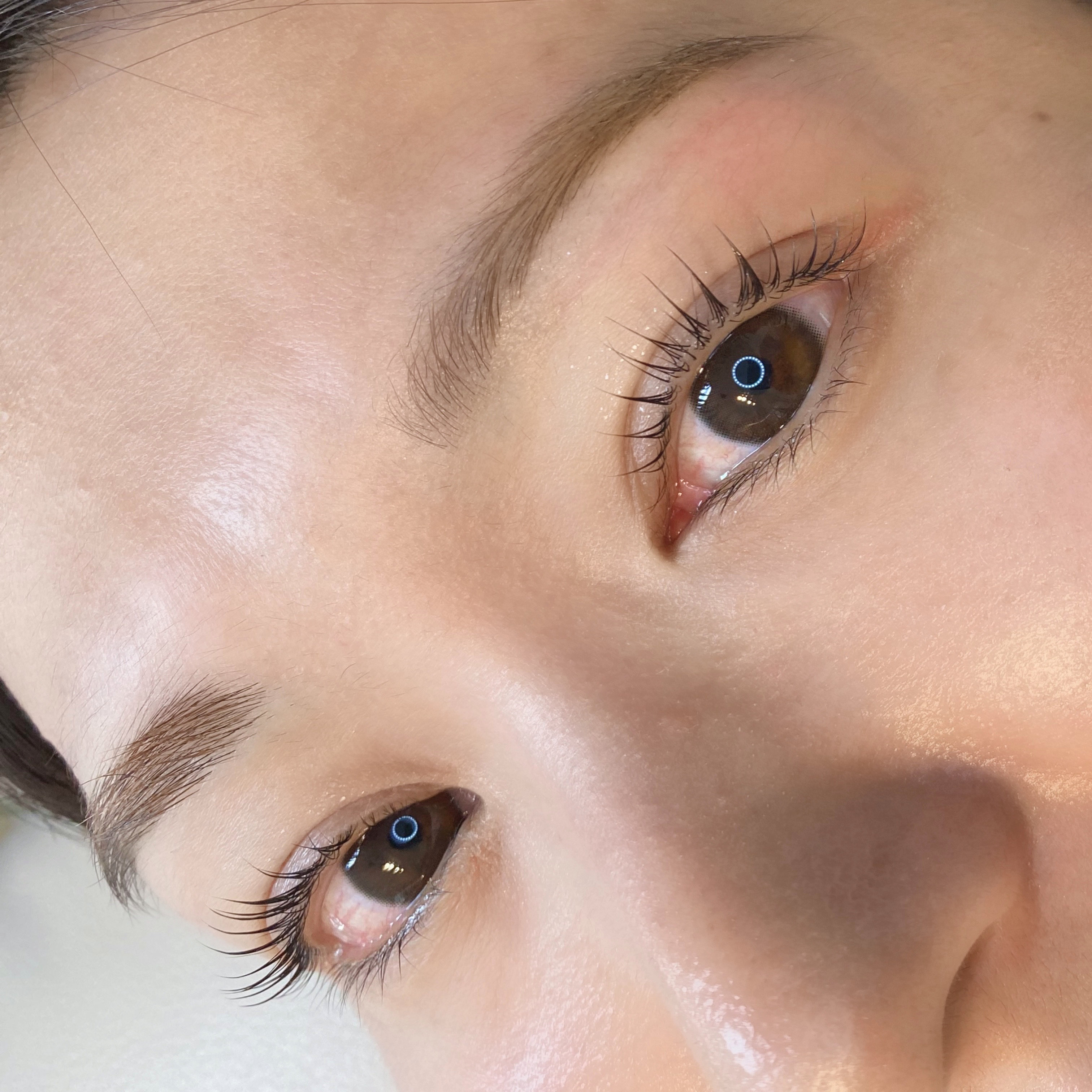 eyelist_aico