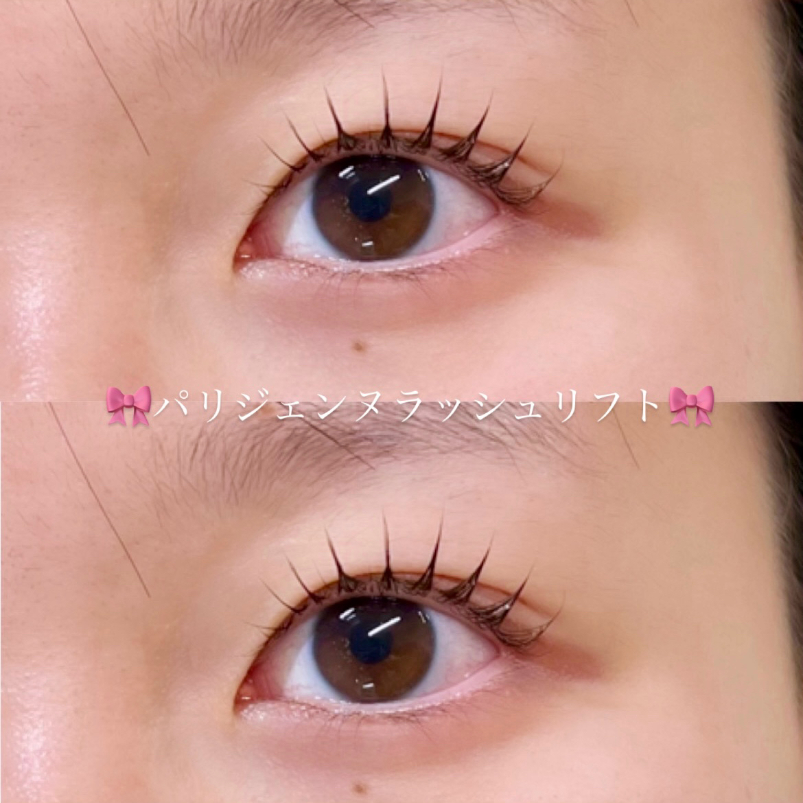yukanida_trueye