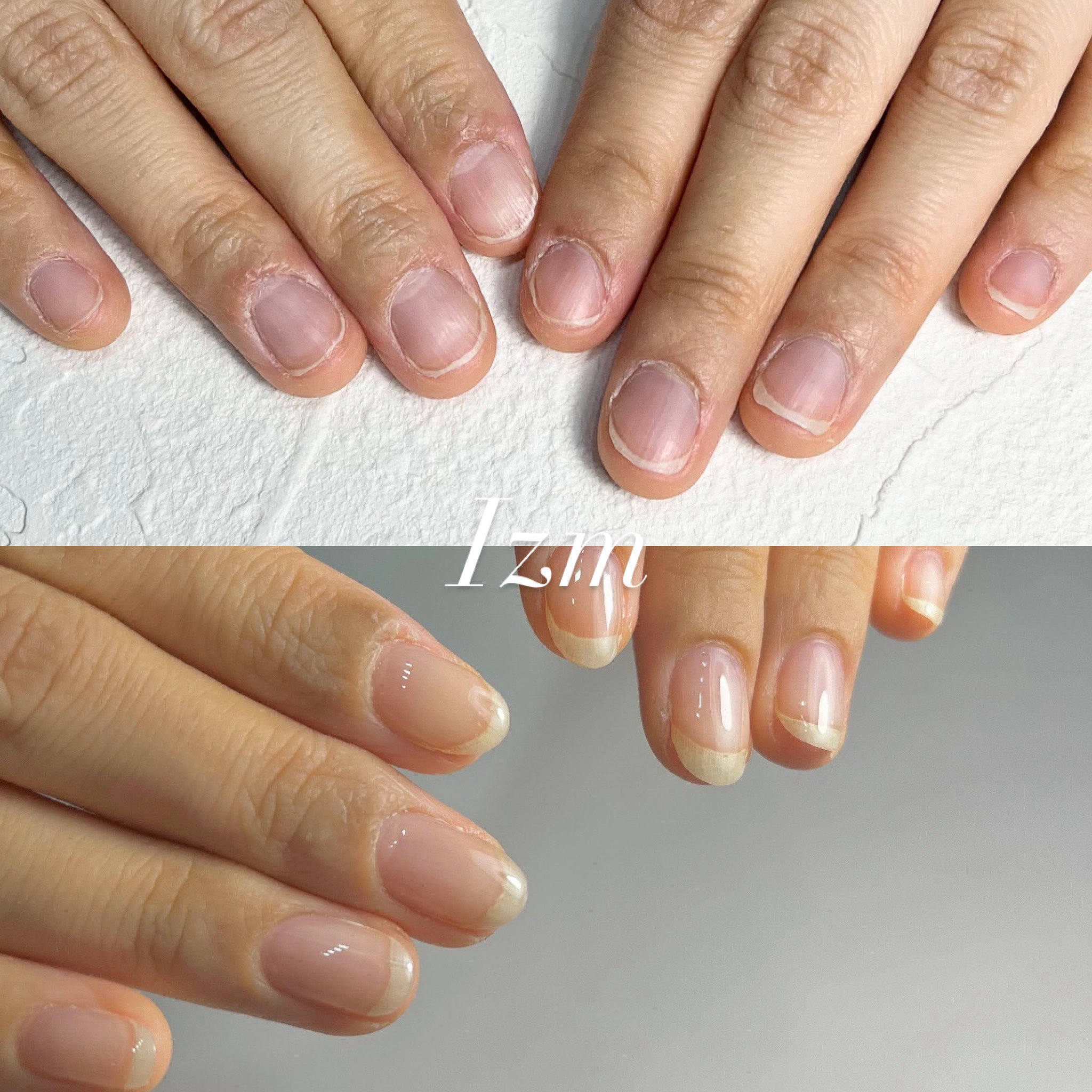 nail_izm