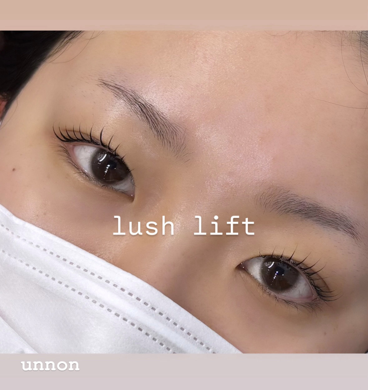 unnon_komabayashi