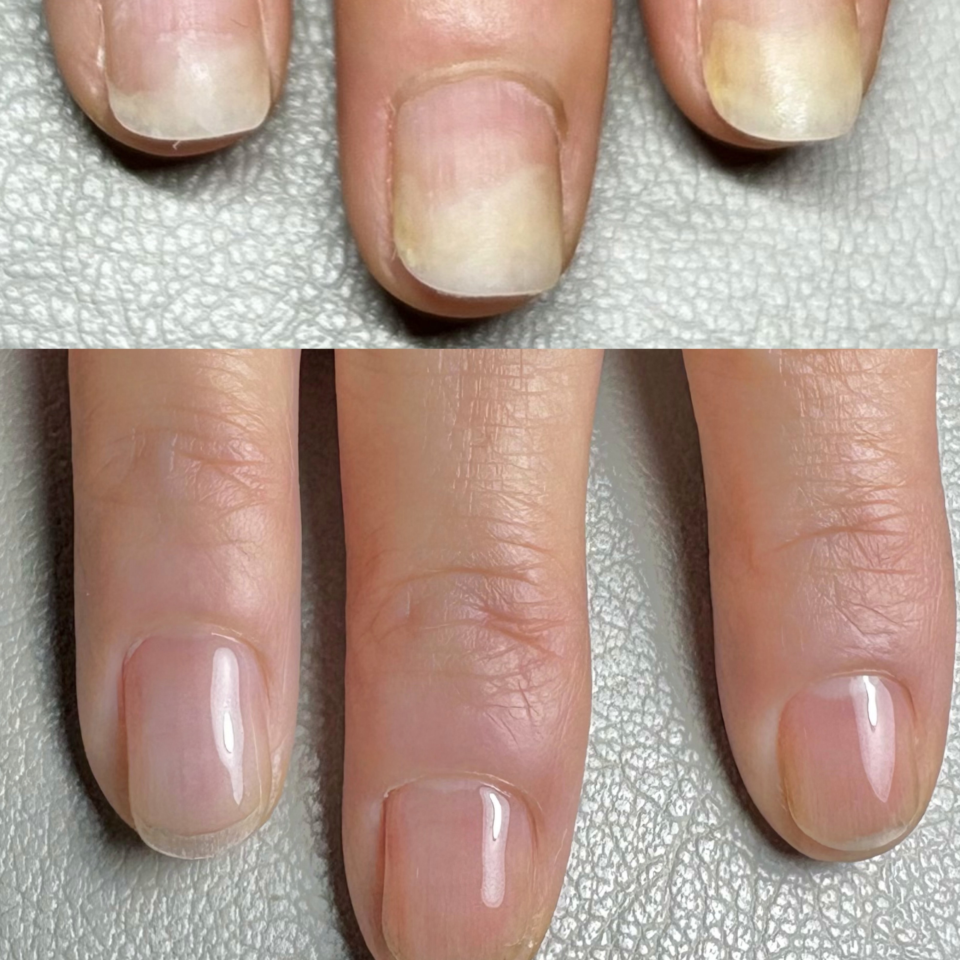 raik_nail