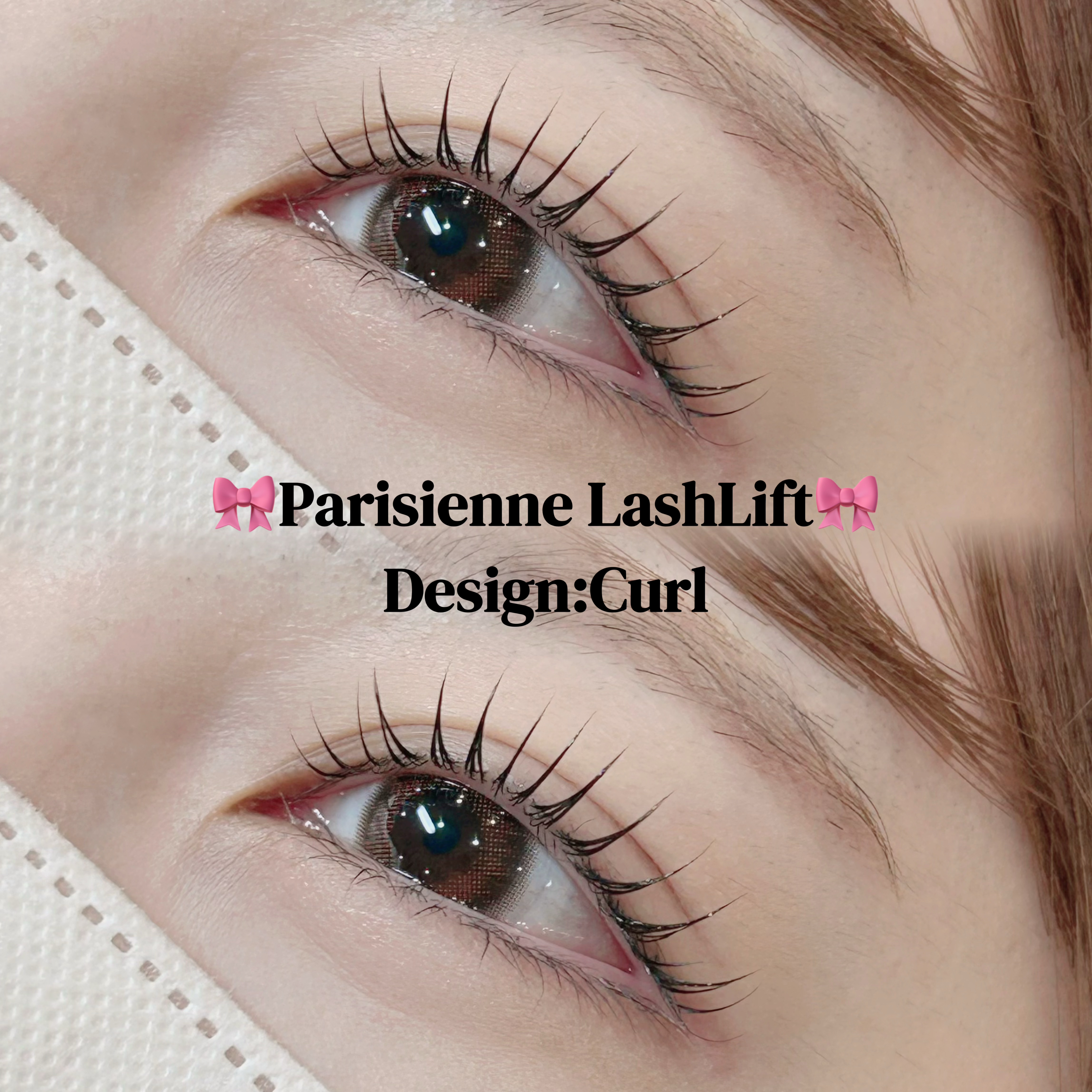 mio_trueye