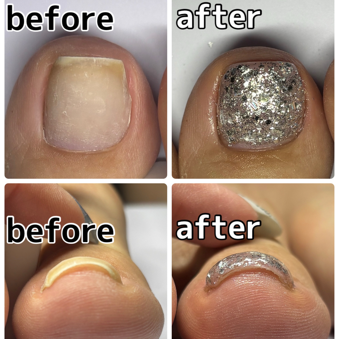 nailkpit