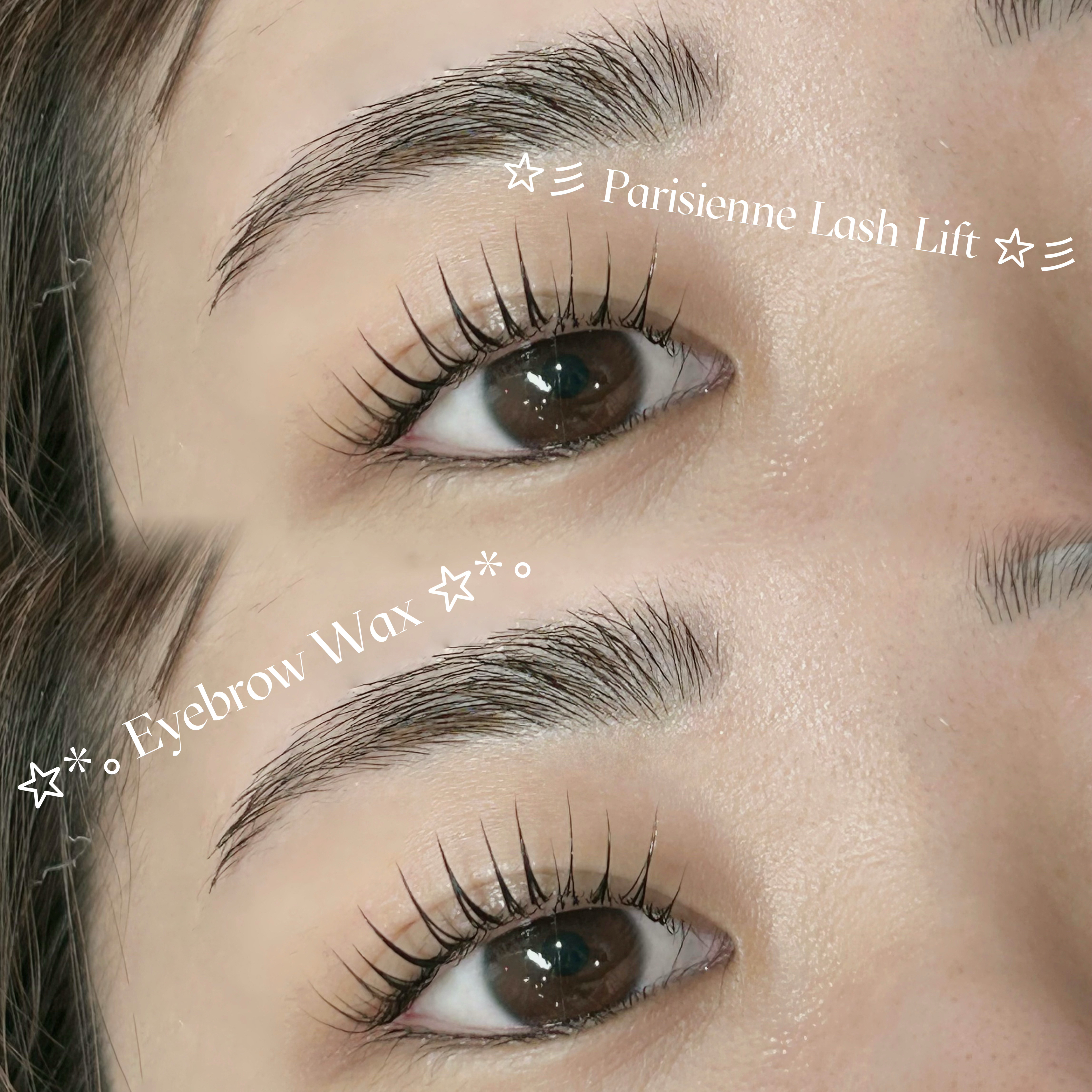 mio_trueye