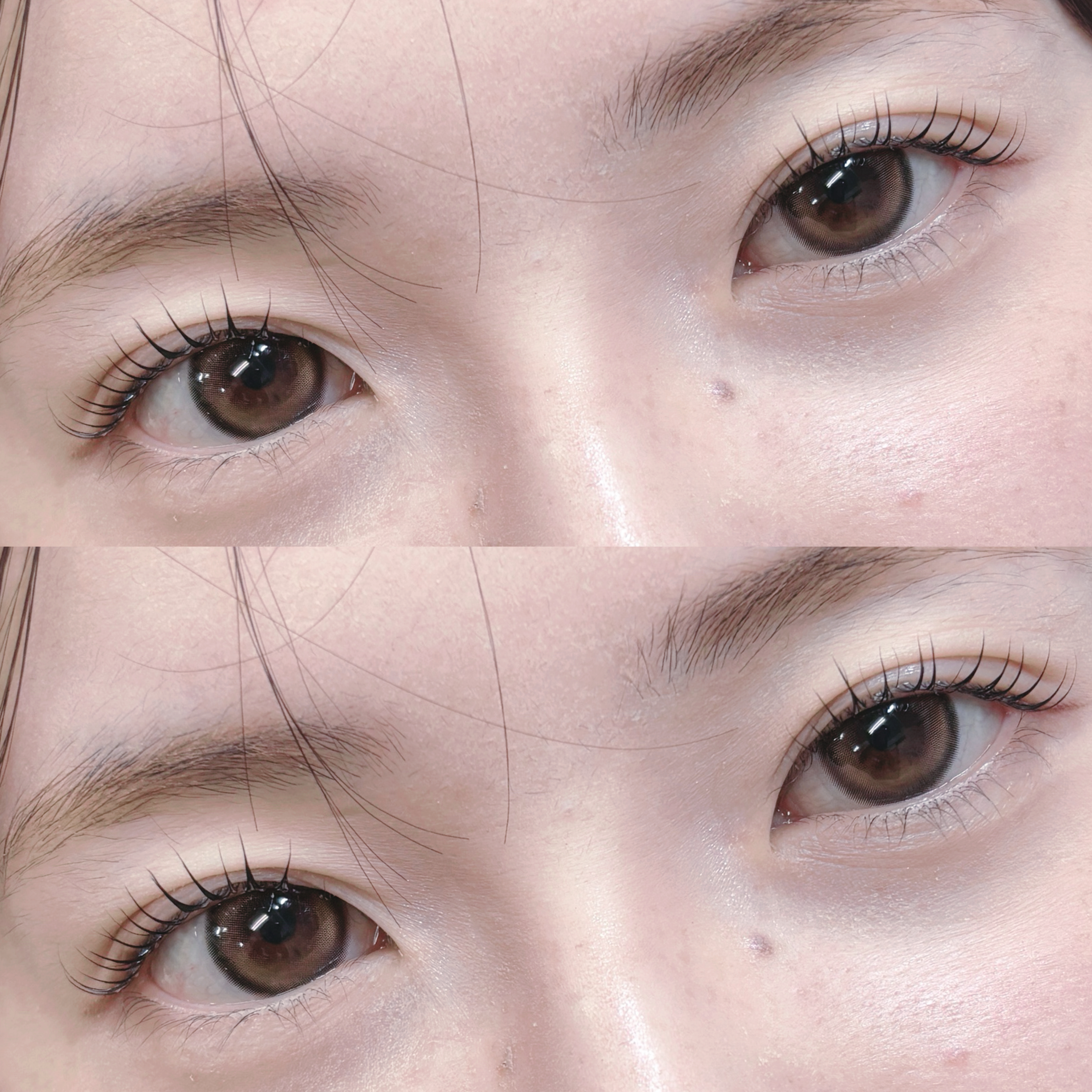 aoi__trueye