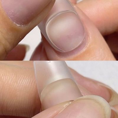 長さ出しチップ