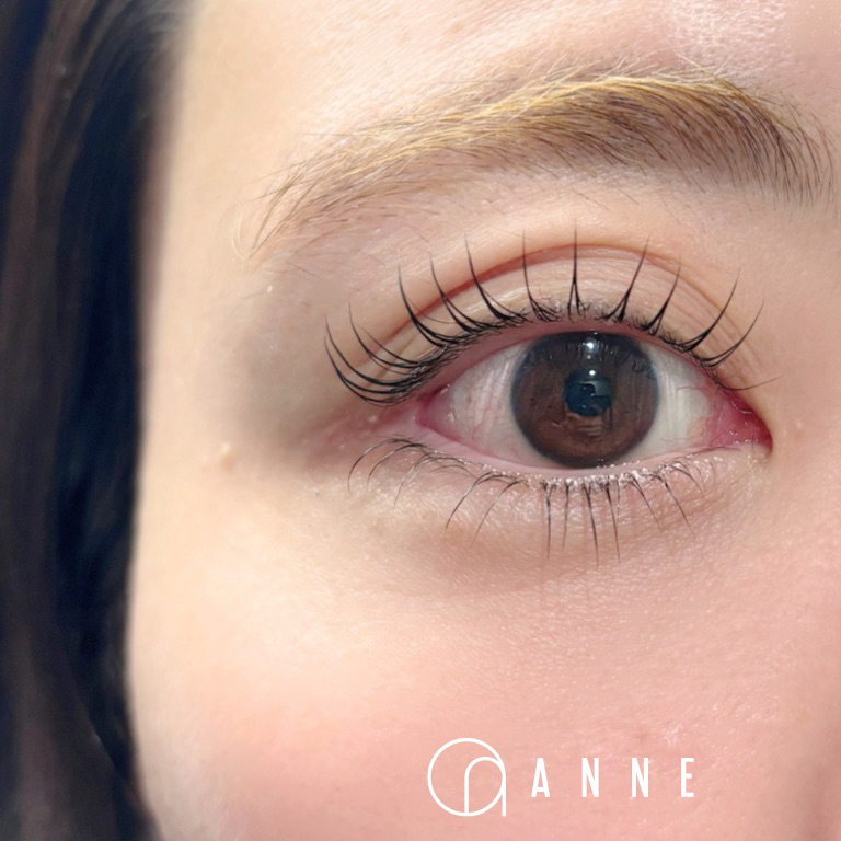 ANNE_akn