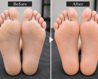 フットオプションケア