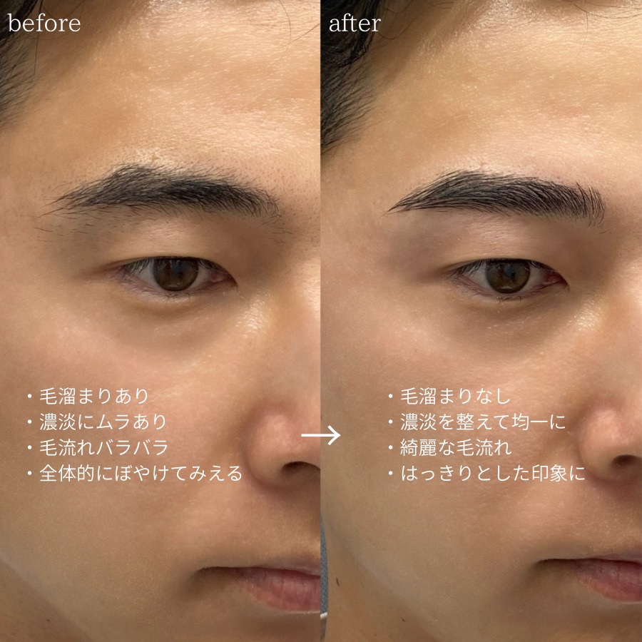 yui_eyelist.