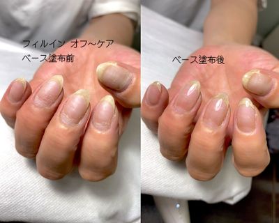 爪育成ケア