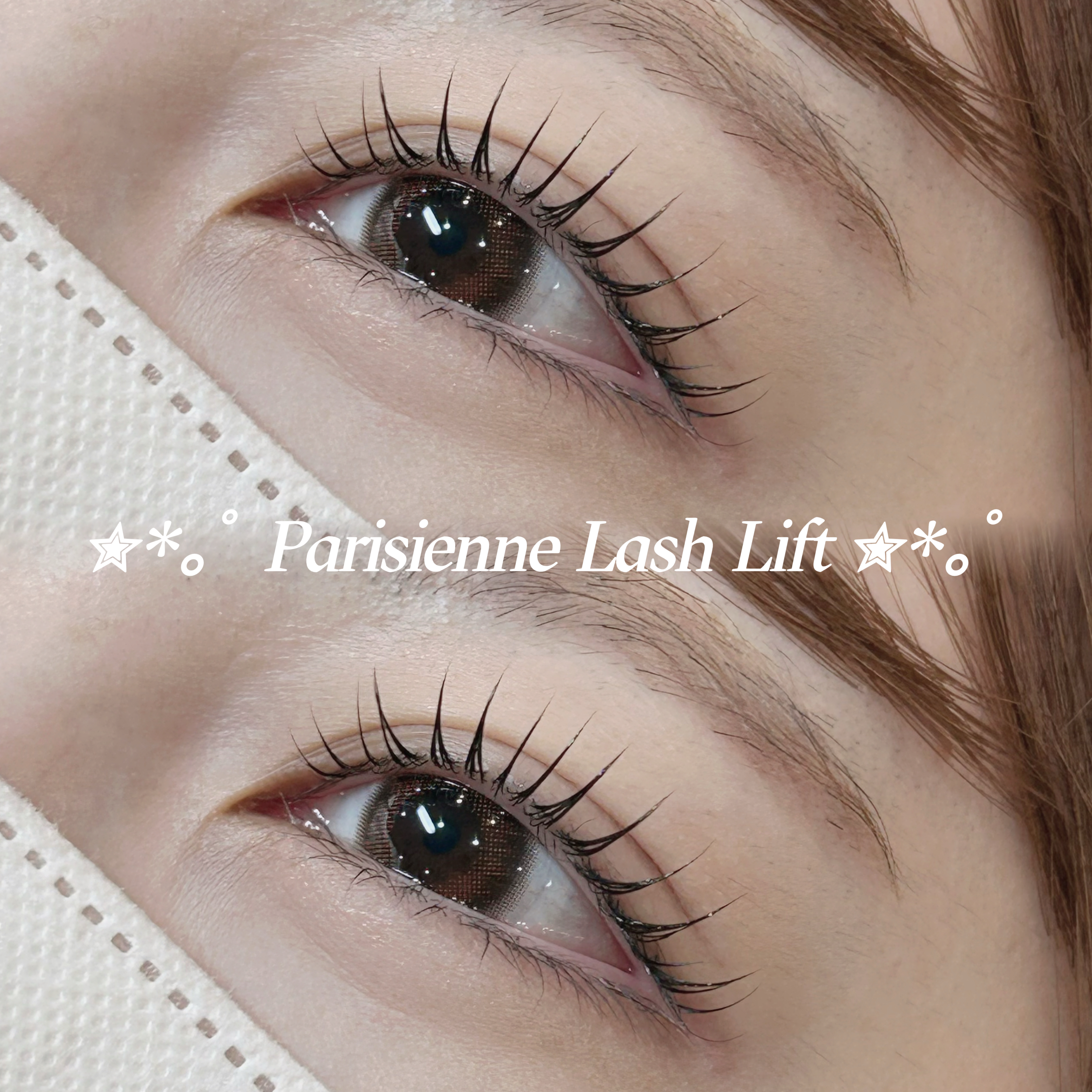 mio_trueye