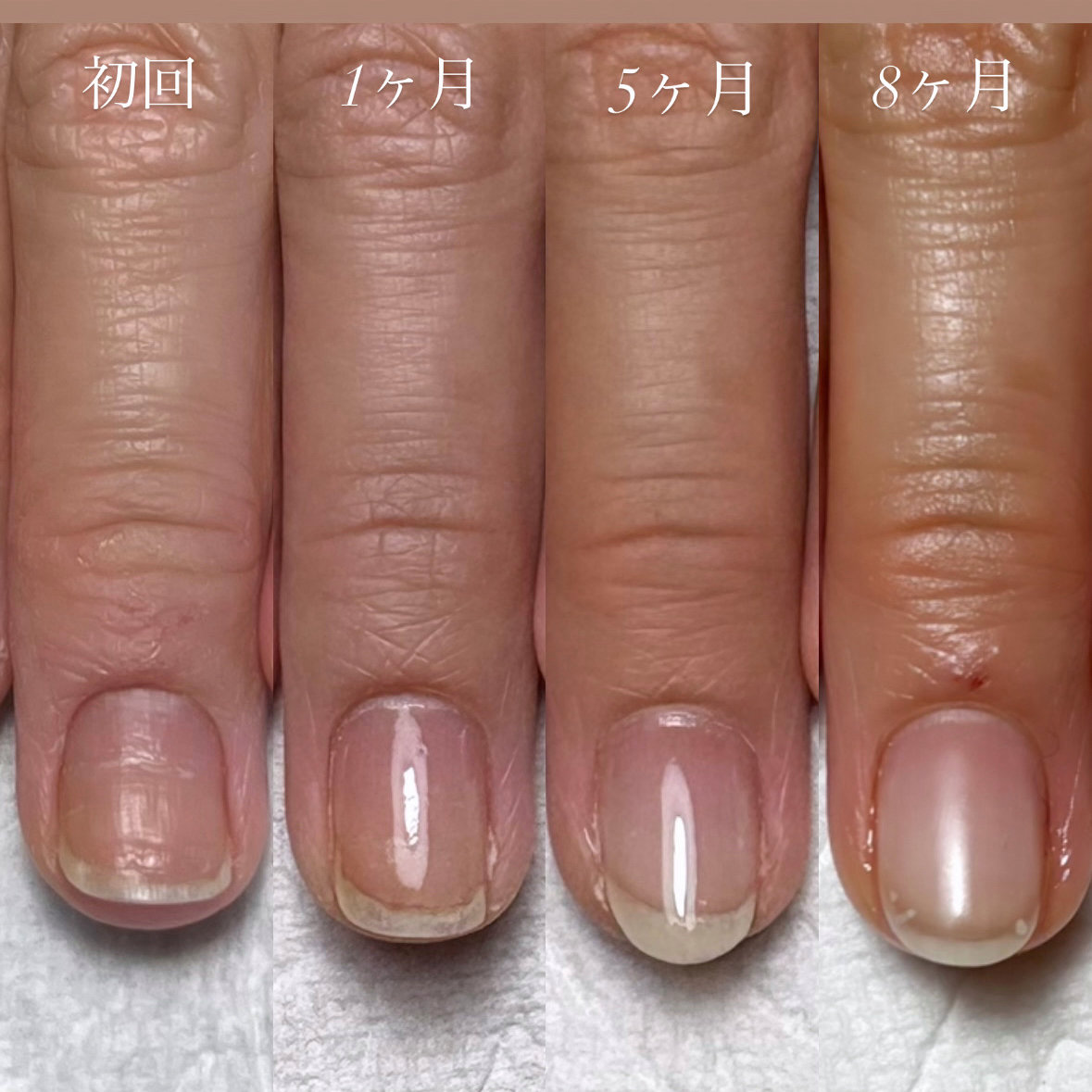 Lino_nail.masami