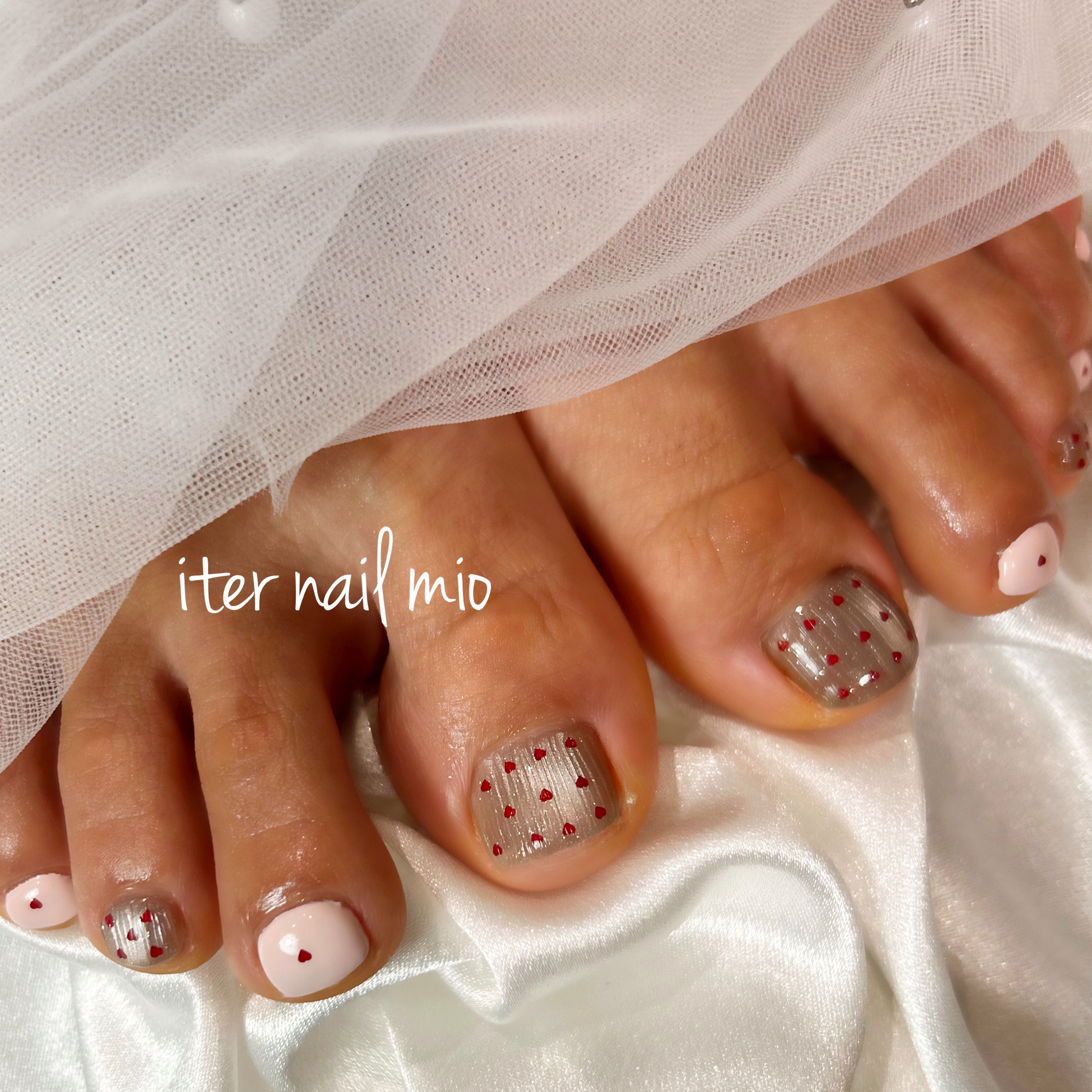 iter_nail_mio