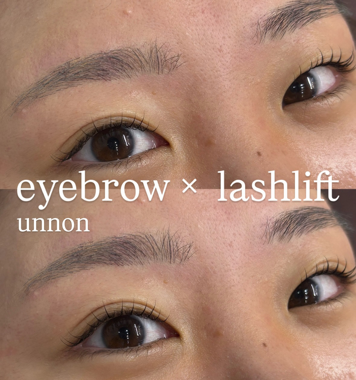 unnon_takeshita