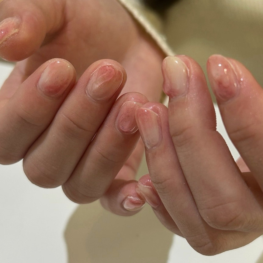 io_____nail