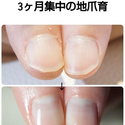 最強ネイルケア