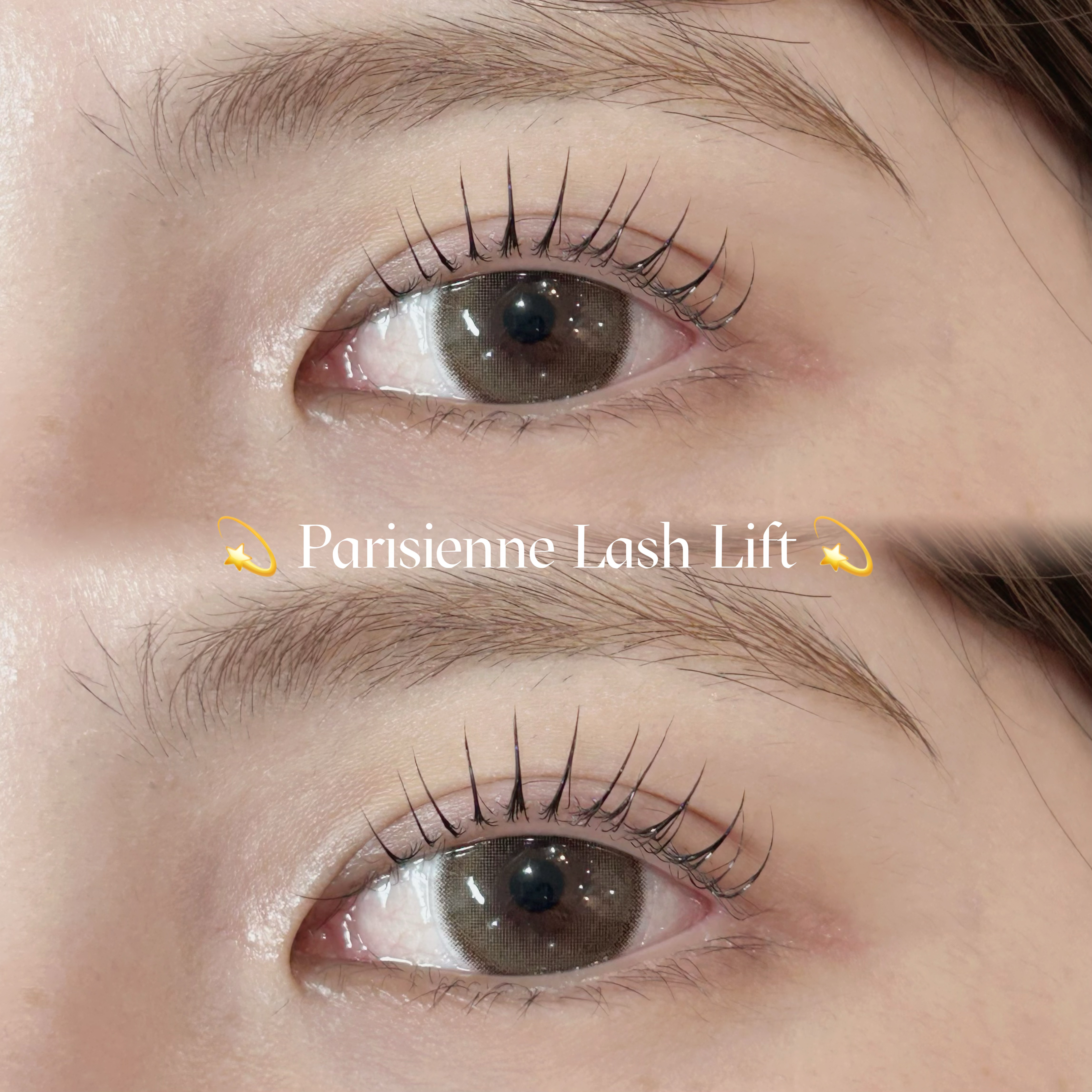 mio_trueye