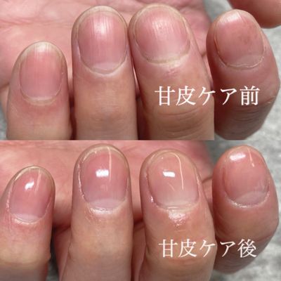 ハンド甘皮ケア🌟