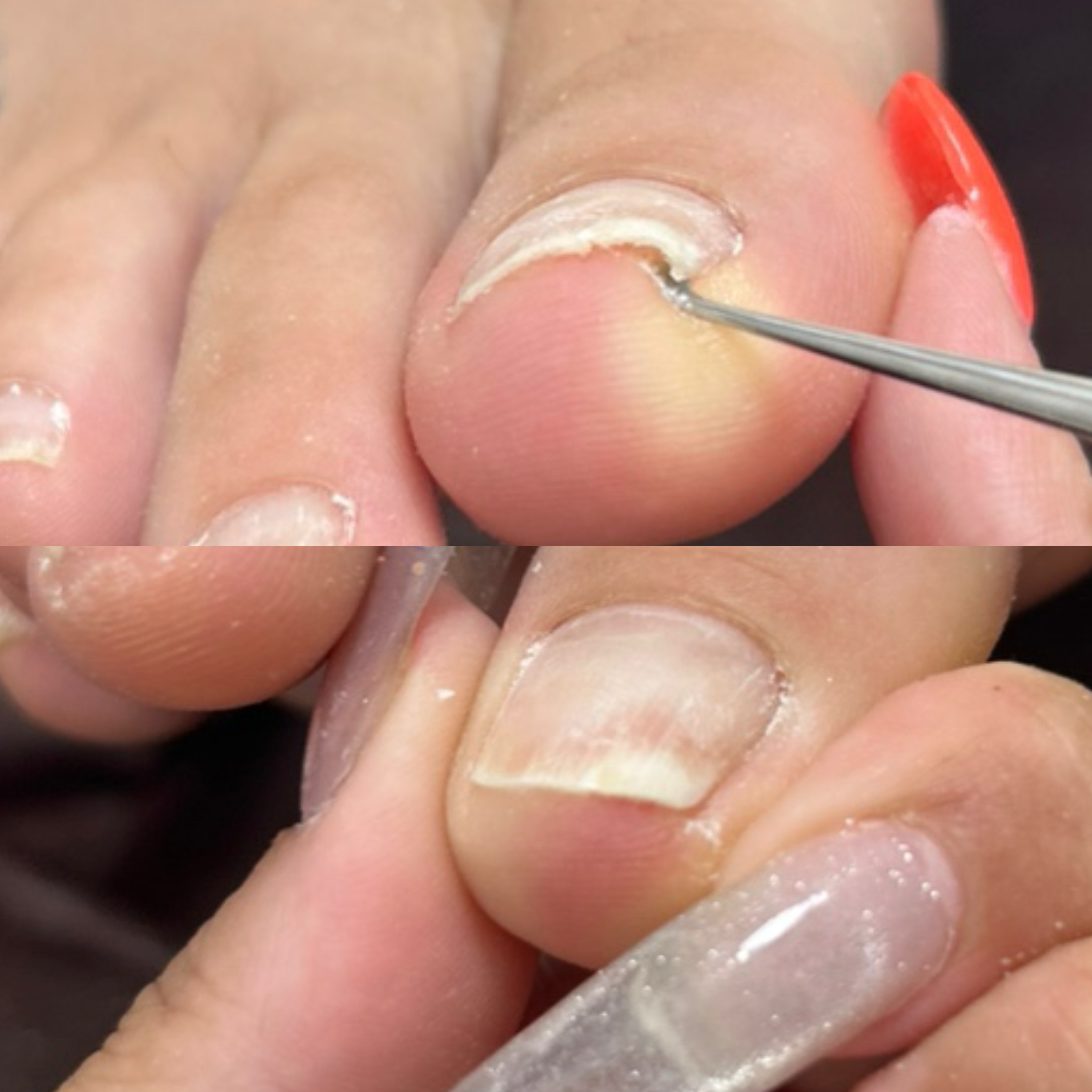 kicoco.nail