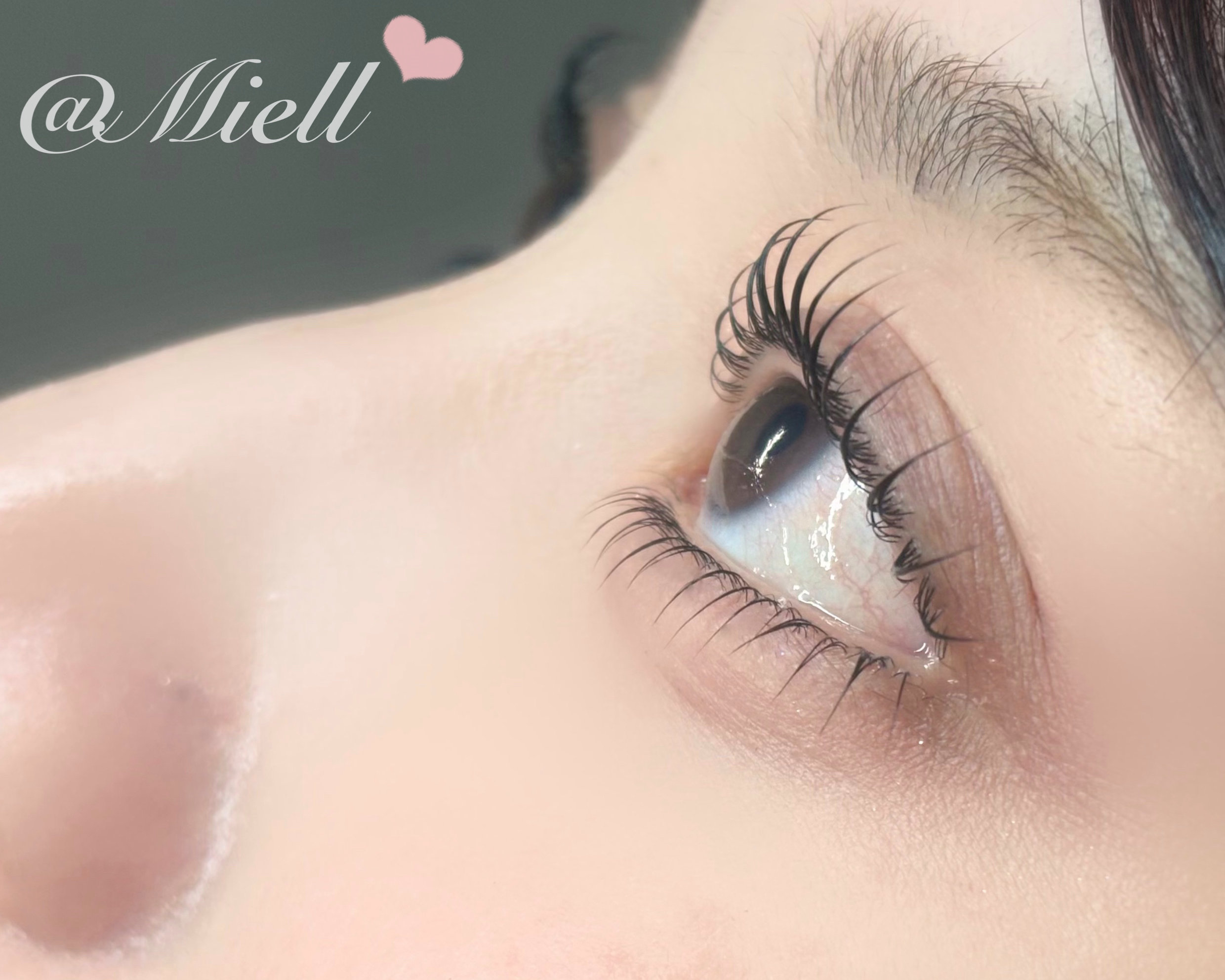 MEI_Miell