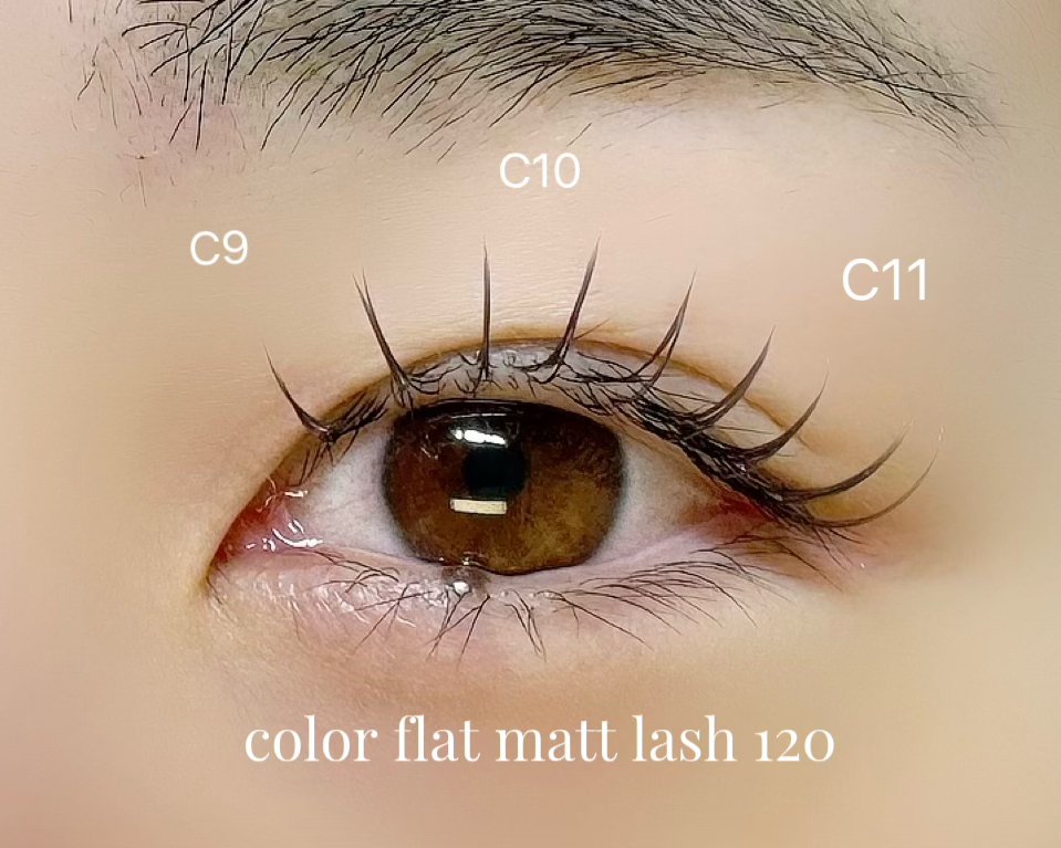 msm_eye