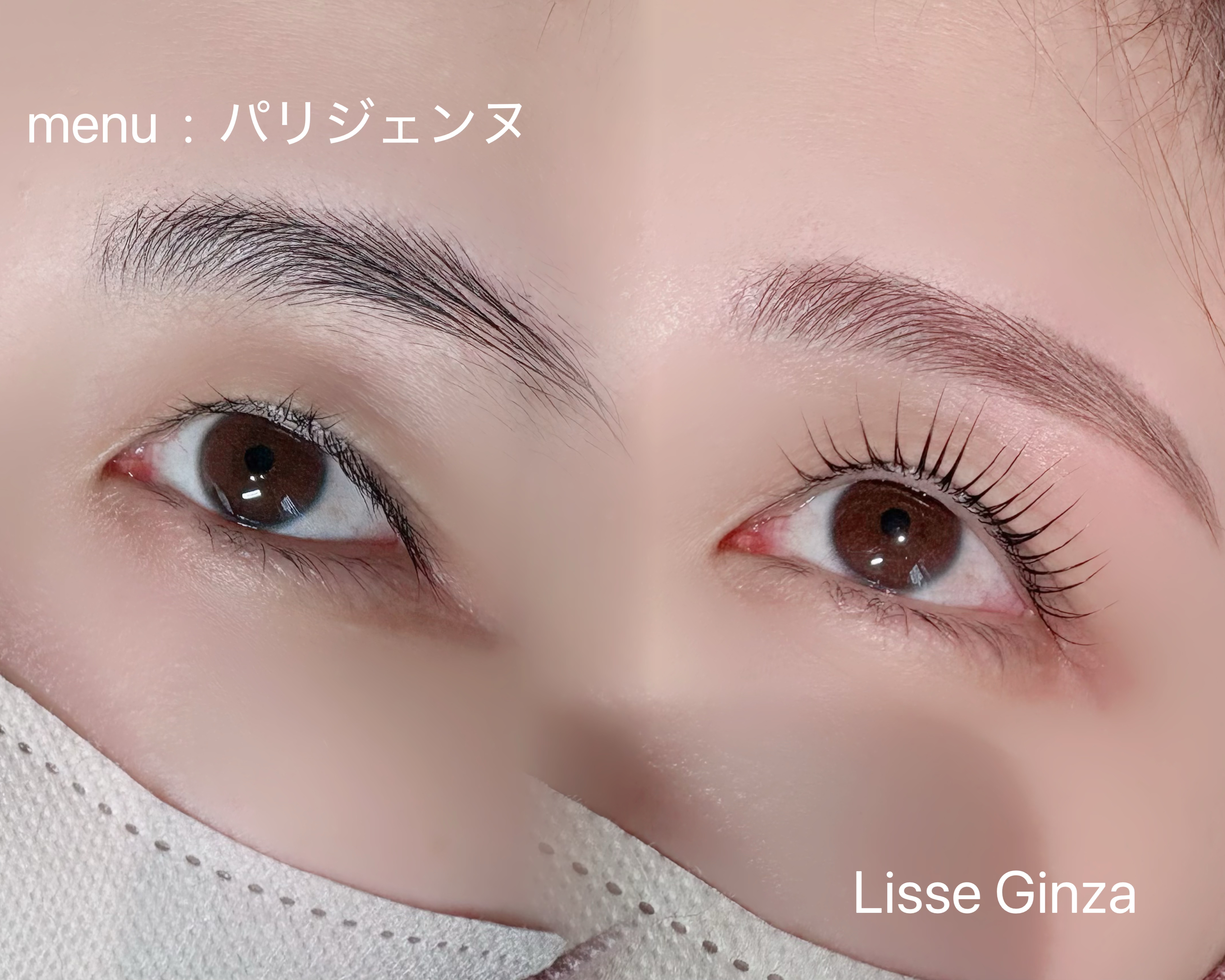 __lisse_aki
