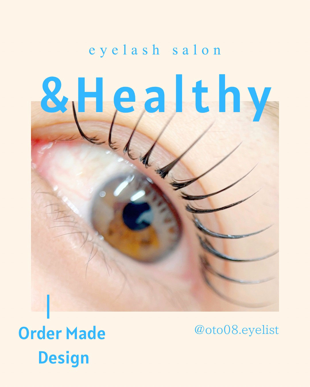 oto08.eyelist