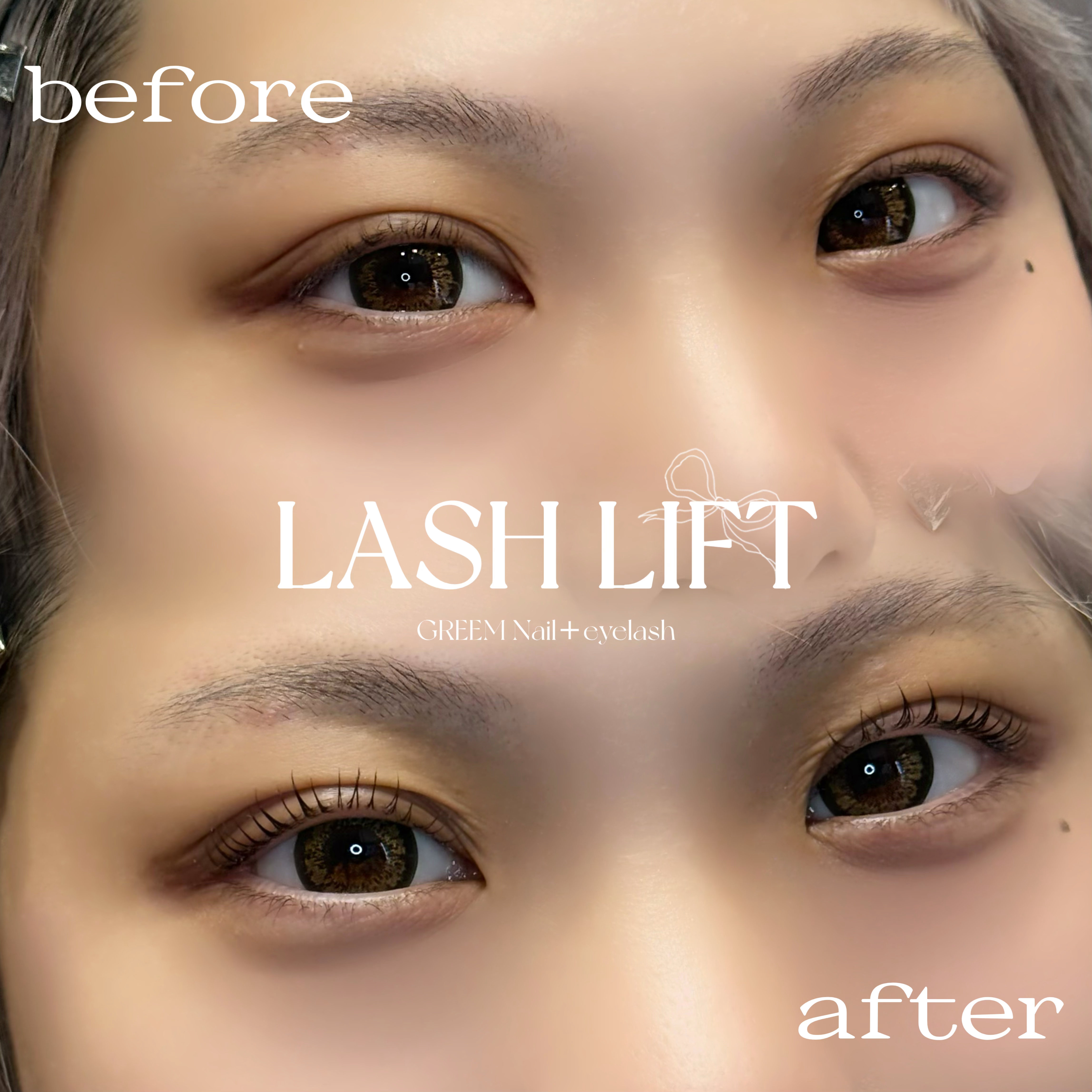 eyelist__chiho