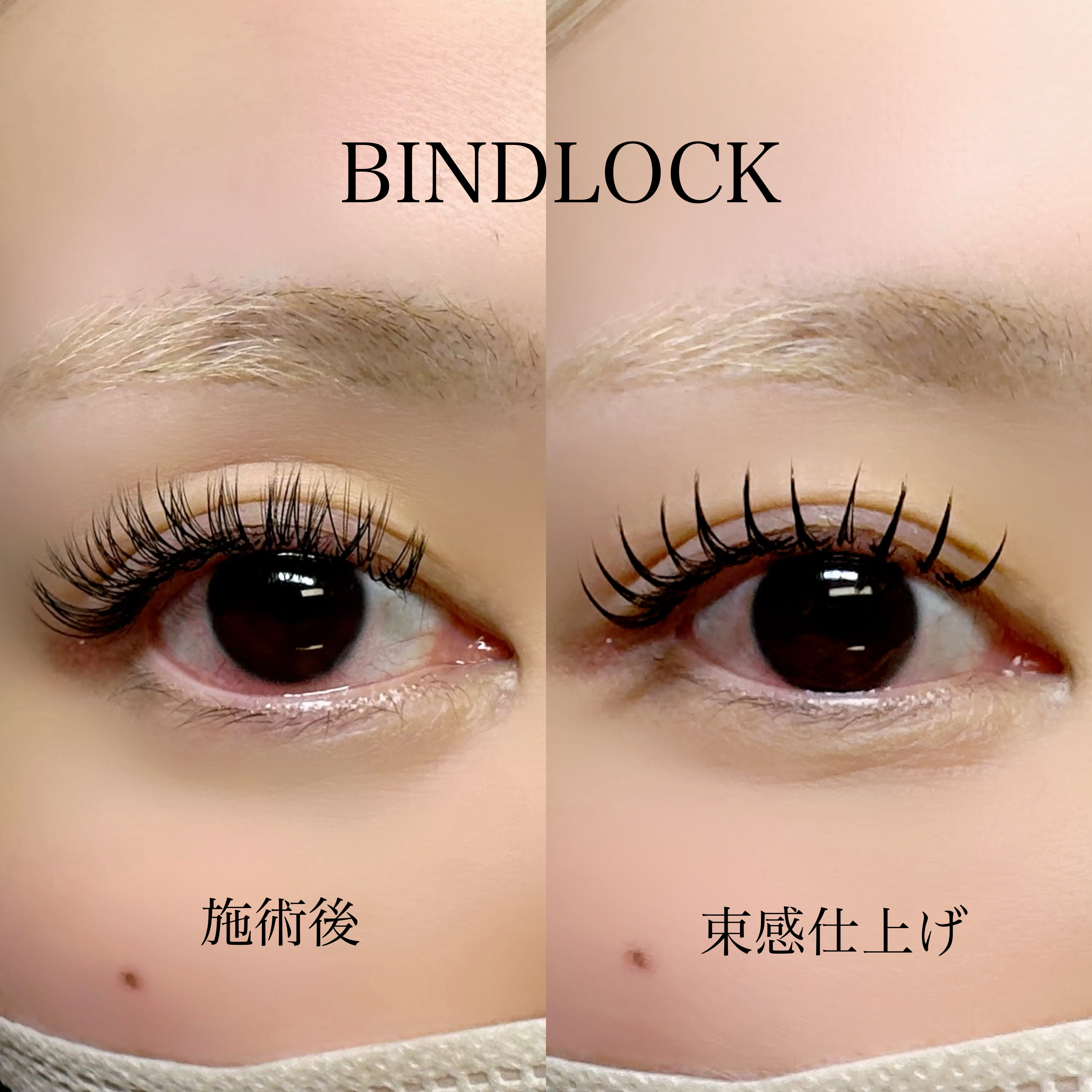 msm_eye