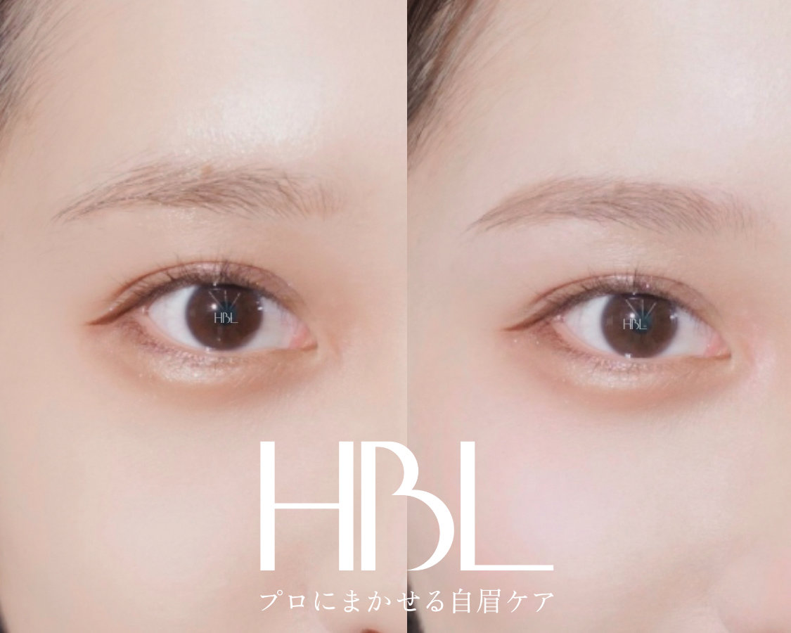 iga_EYE405