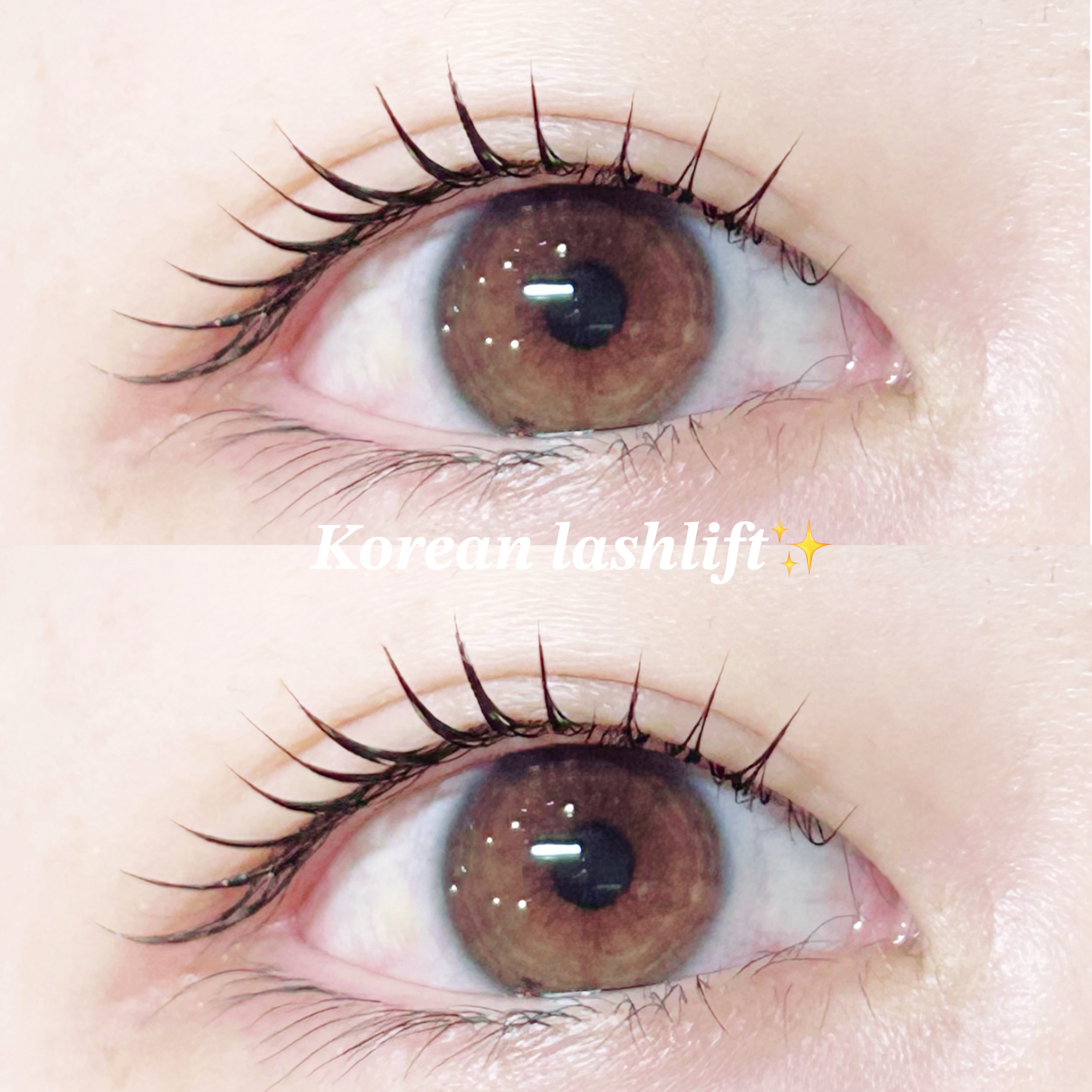 emi_trueye