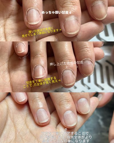 ハンドケア