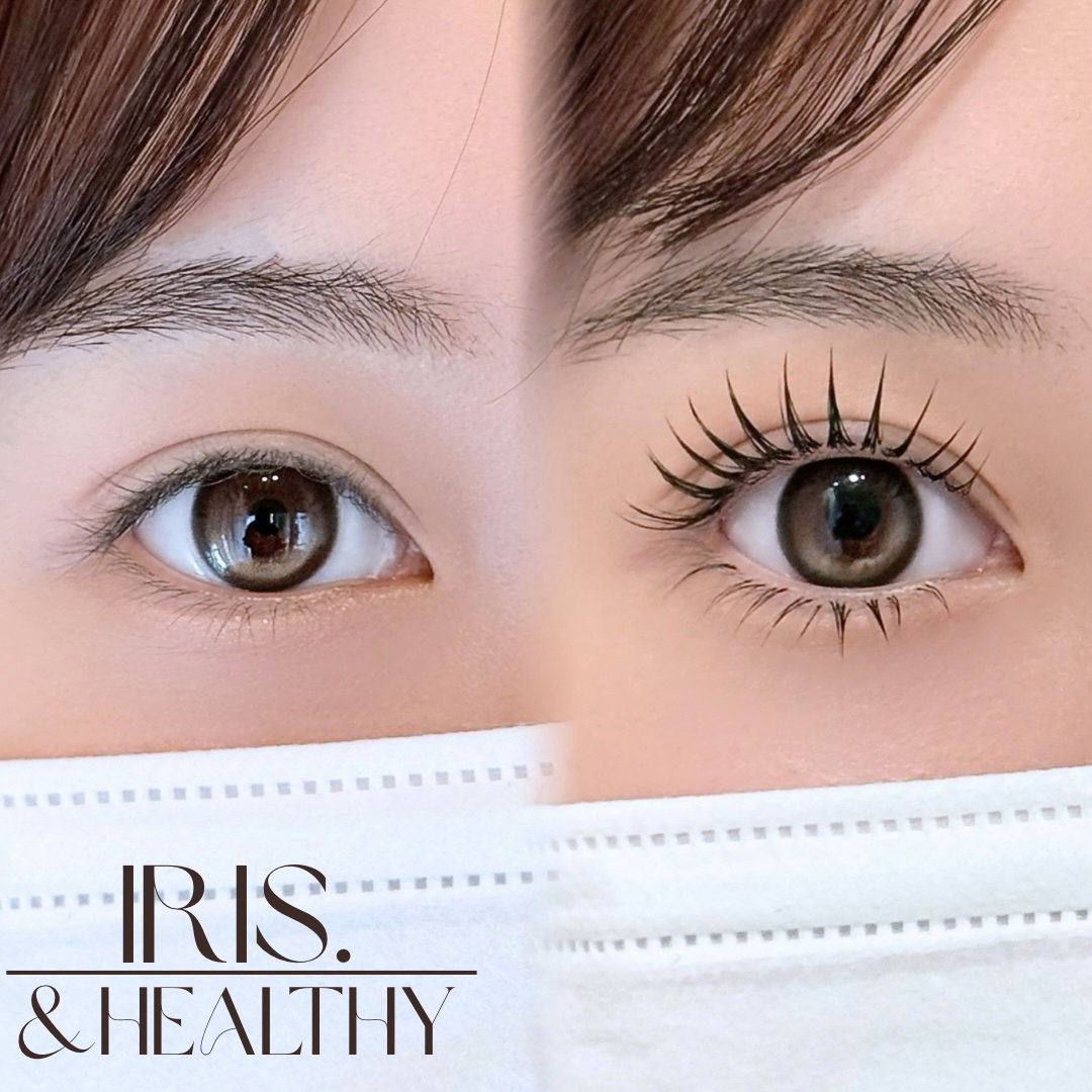 IRIS._rina