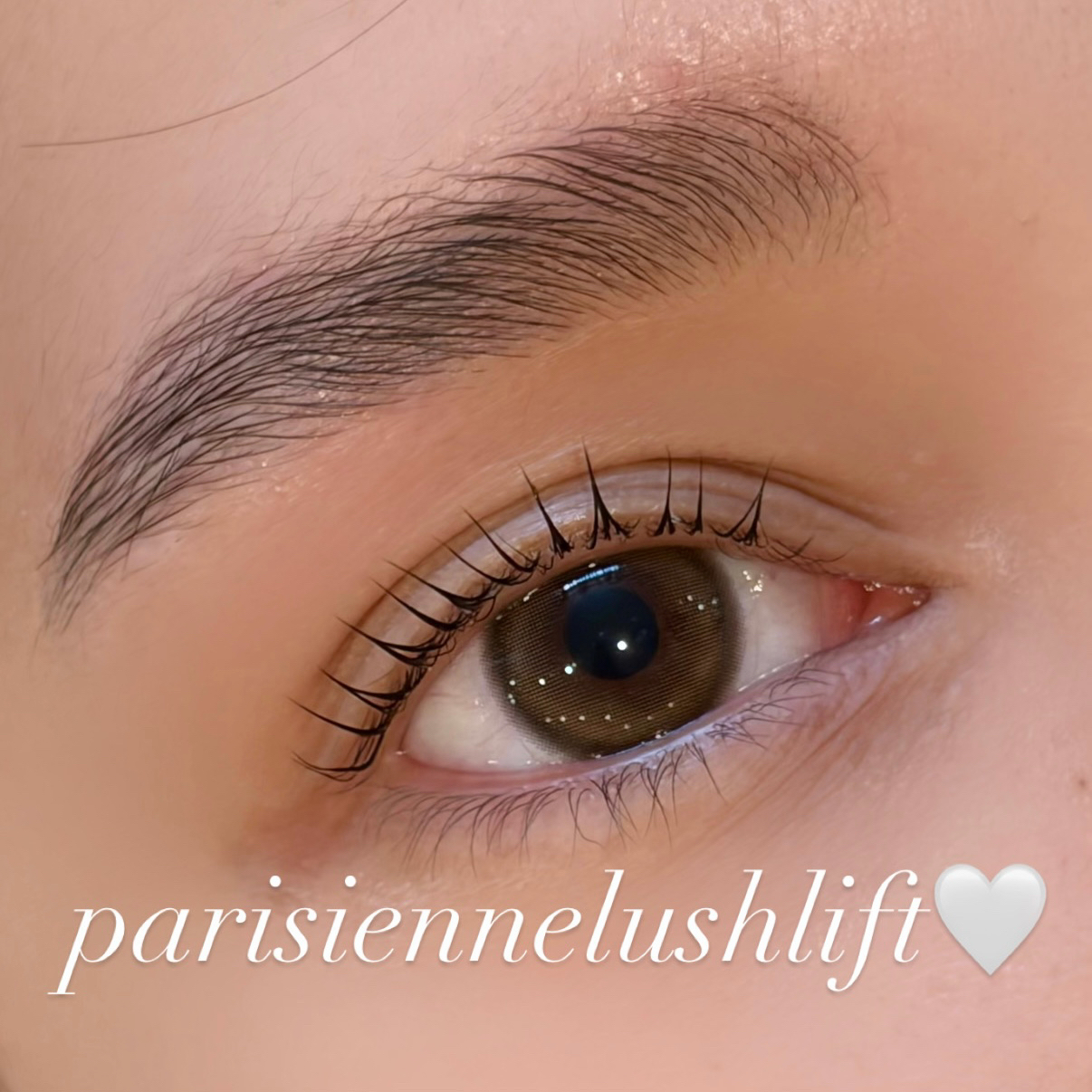 runa._trueye