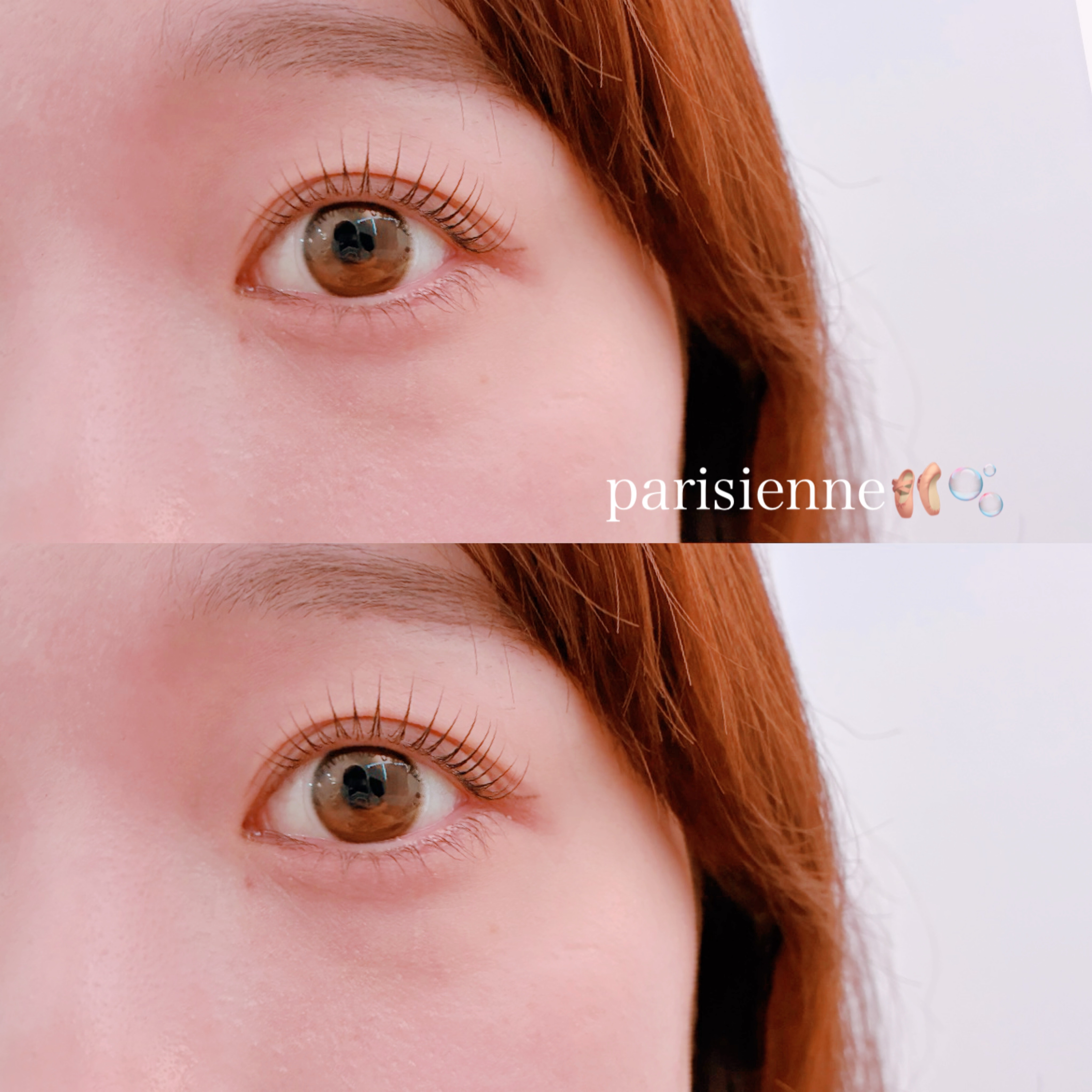 keito_trueye