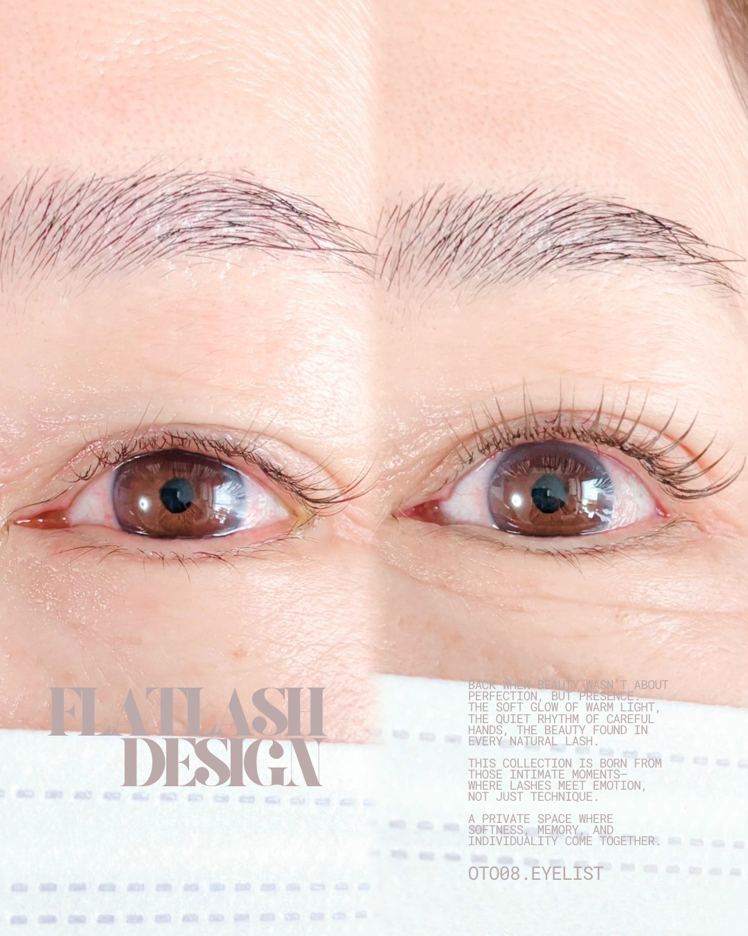 oto08.eyelist