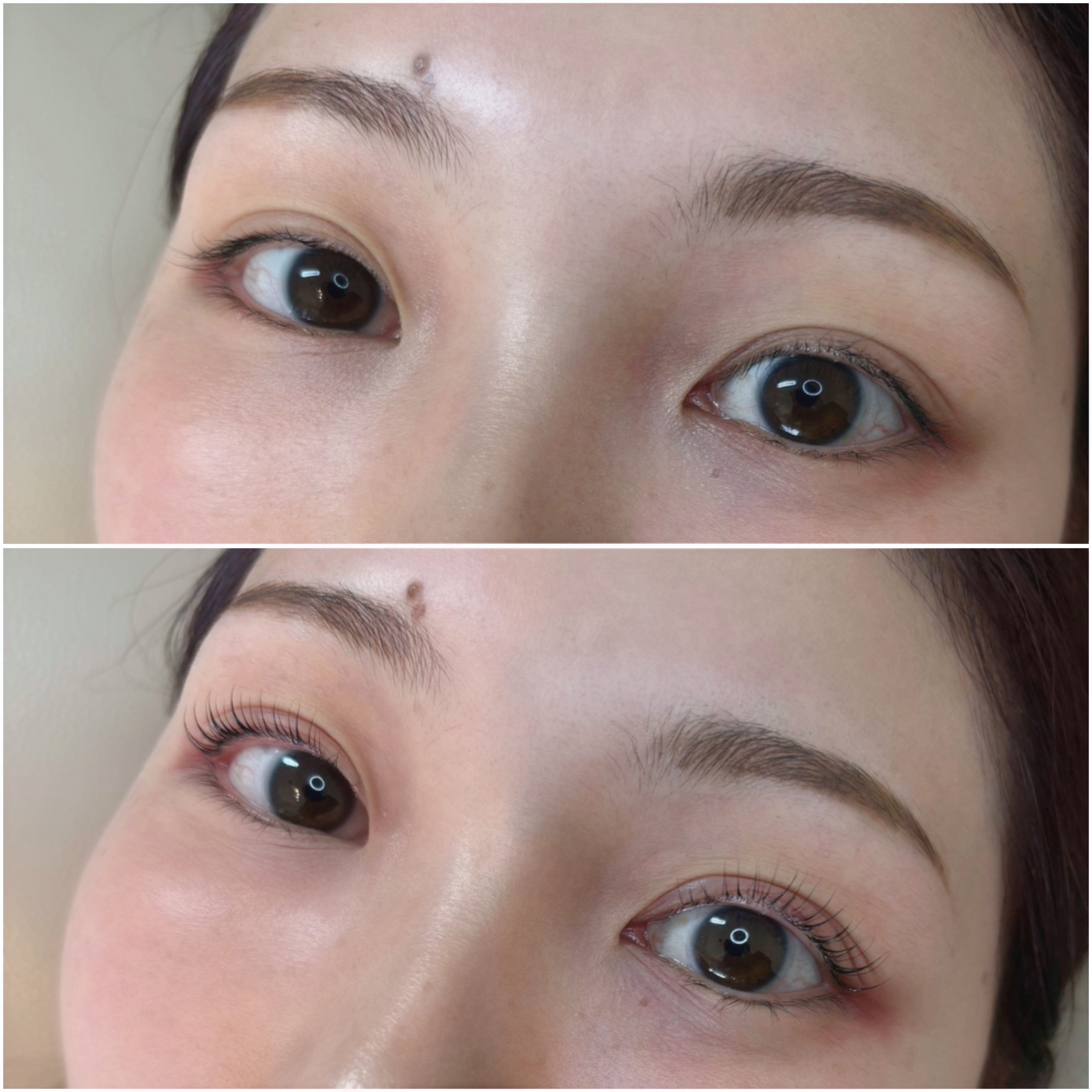 eyelist_aico