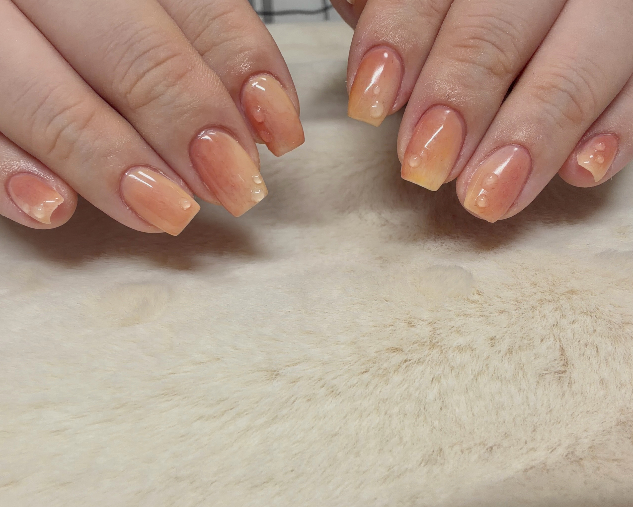 nail_100e